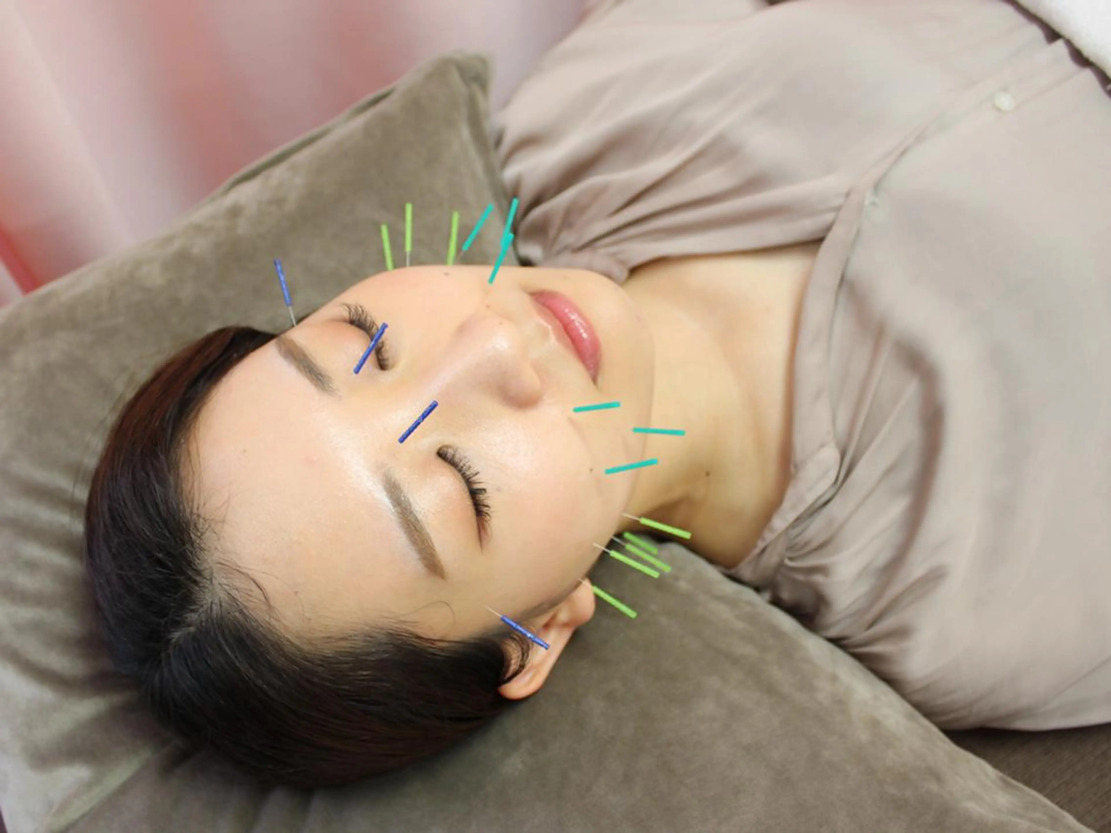 エステ リラク 同心整骨院 美容鍼・整体・小顔のエステ・リラクイメージ