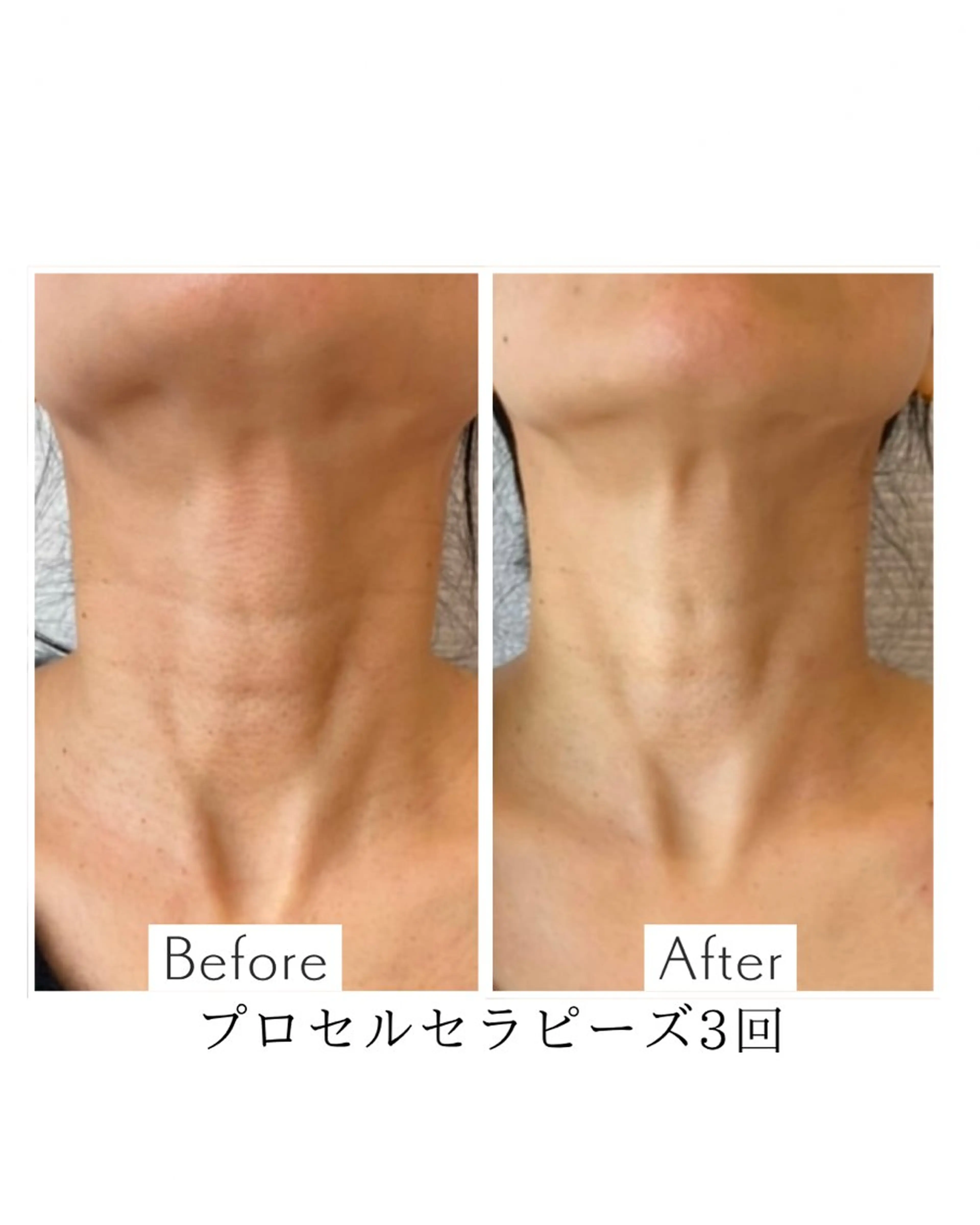 エステ private salon Aola所属・プライベートサロン アオラのネイルデザイン