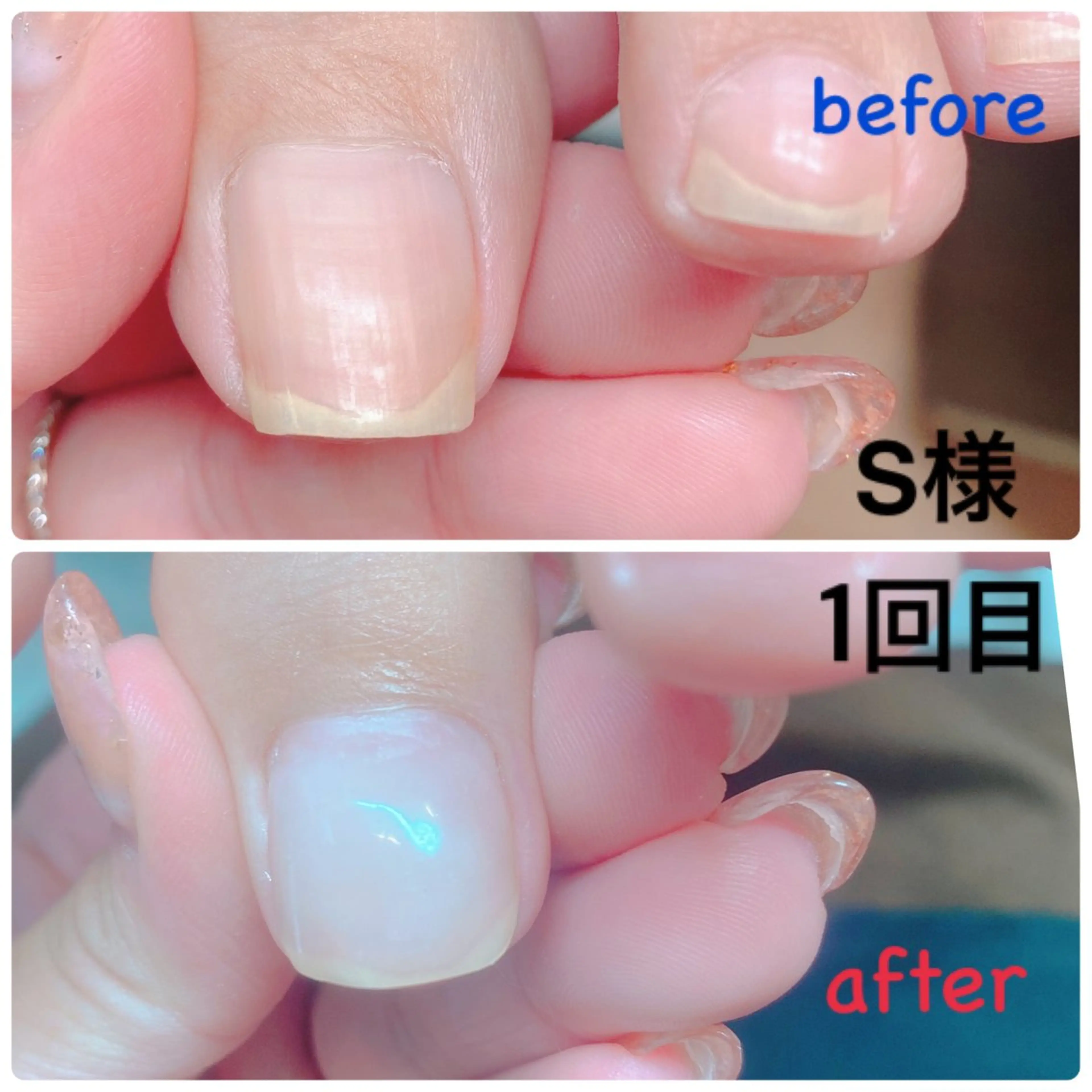 ネイル その他(ネイル) 柴崎 美幸のネイルデザイン