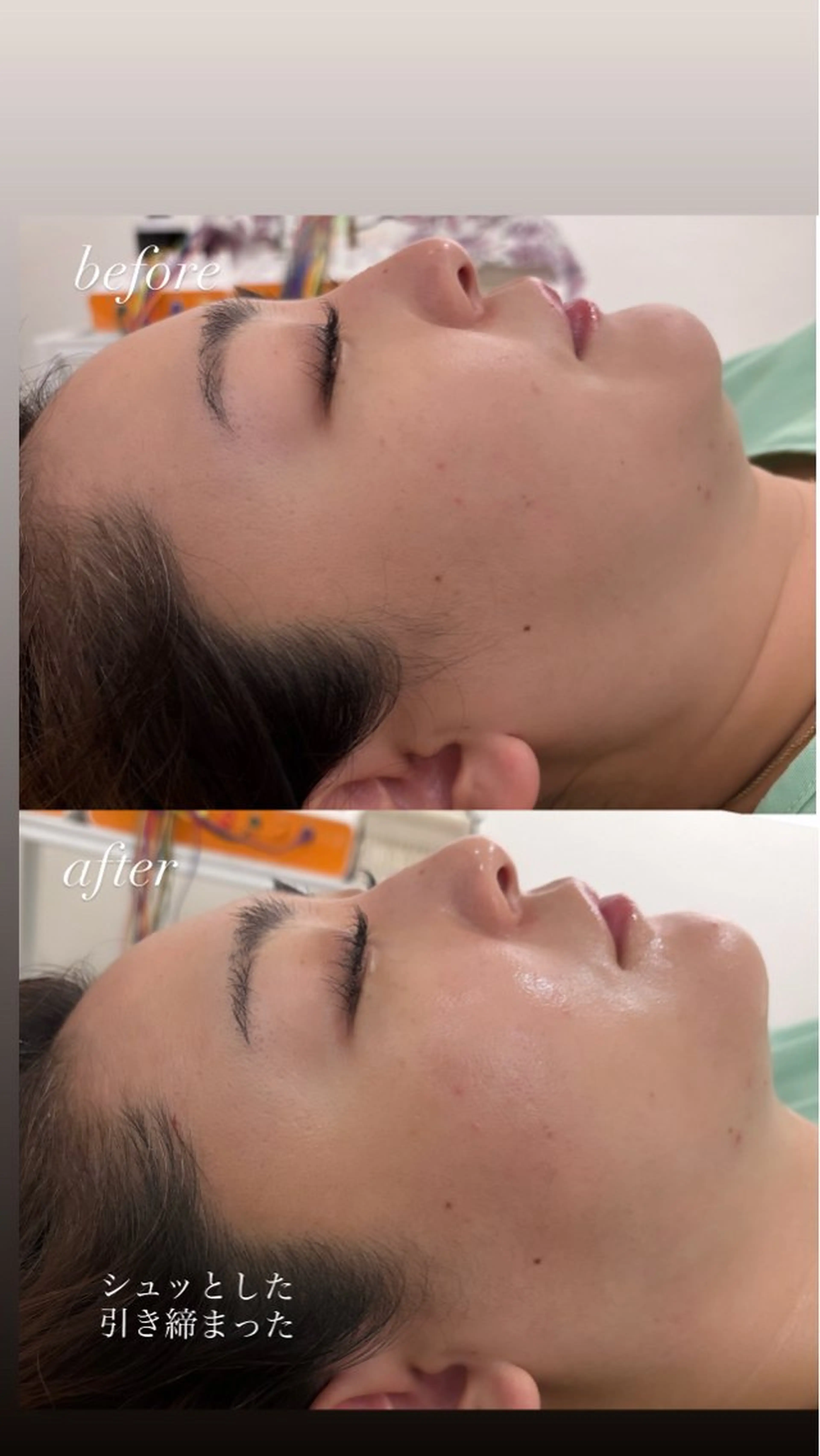 エステ リラク 美容鍼灸サロン mahoroba院長のエステ・リラクイメージ