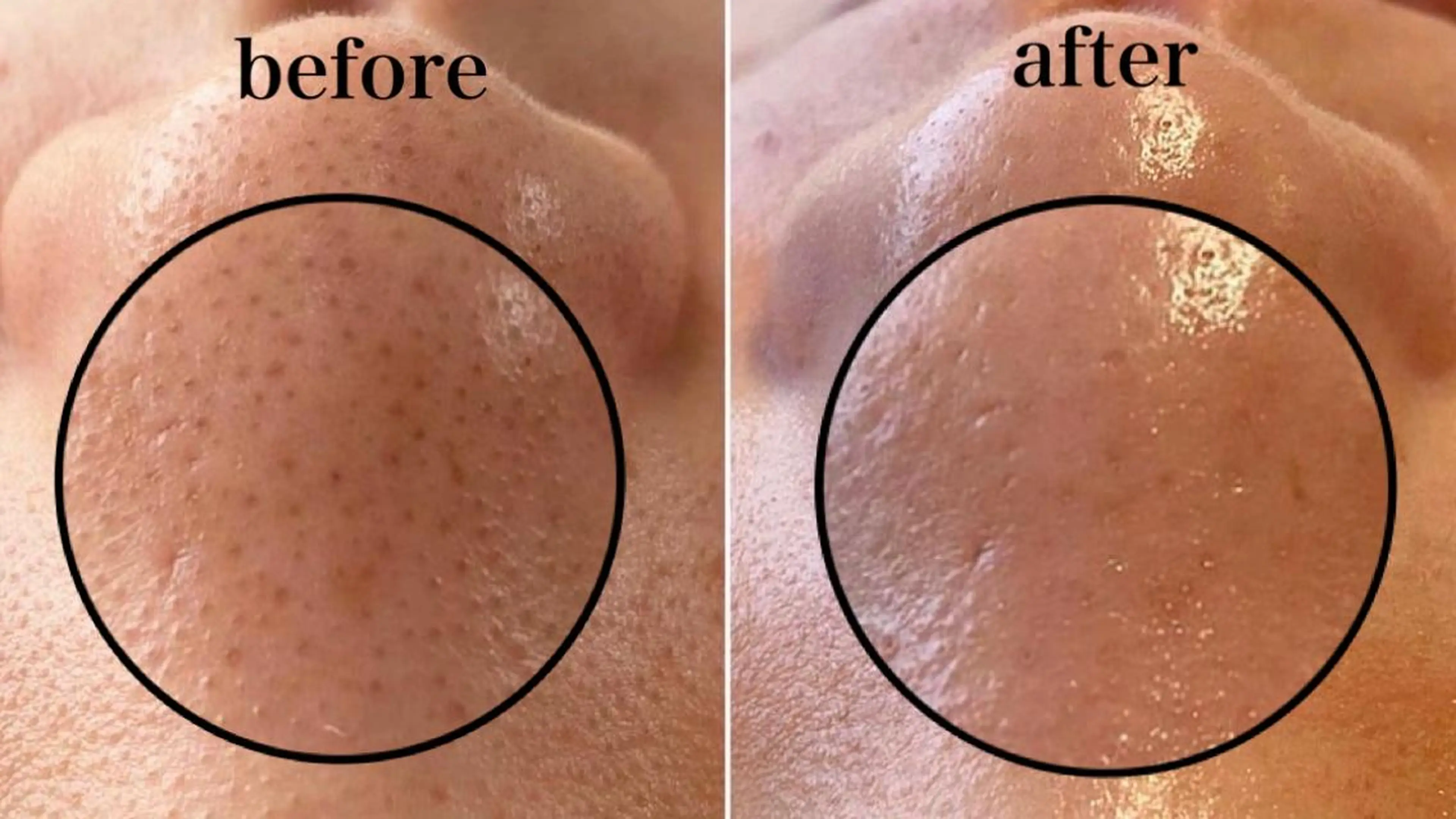 マツエク・マツパ エステ リラク 韓国肌管理 【毛穴専科】のエステ・リラクイメージ