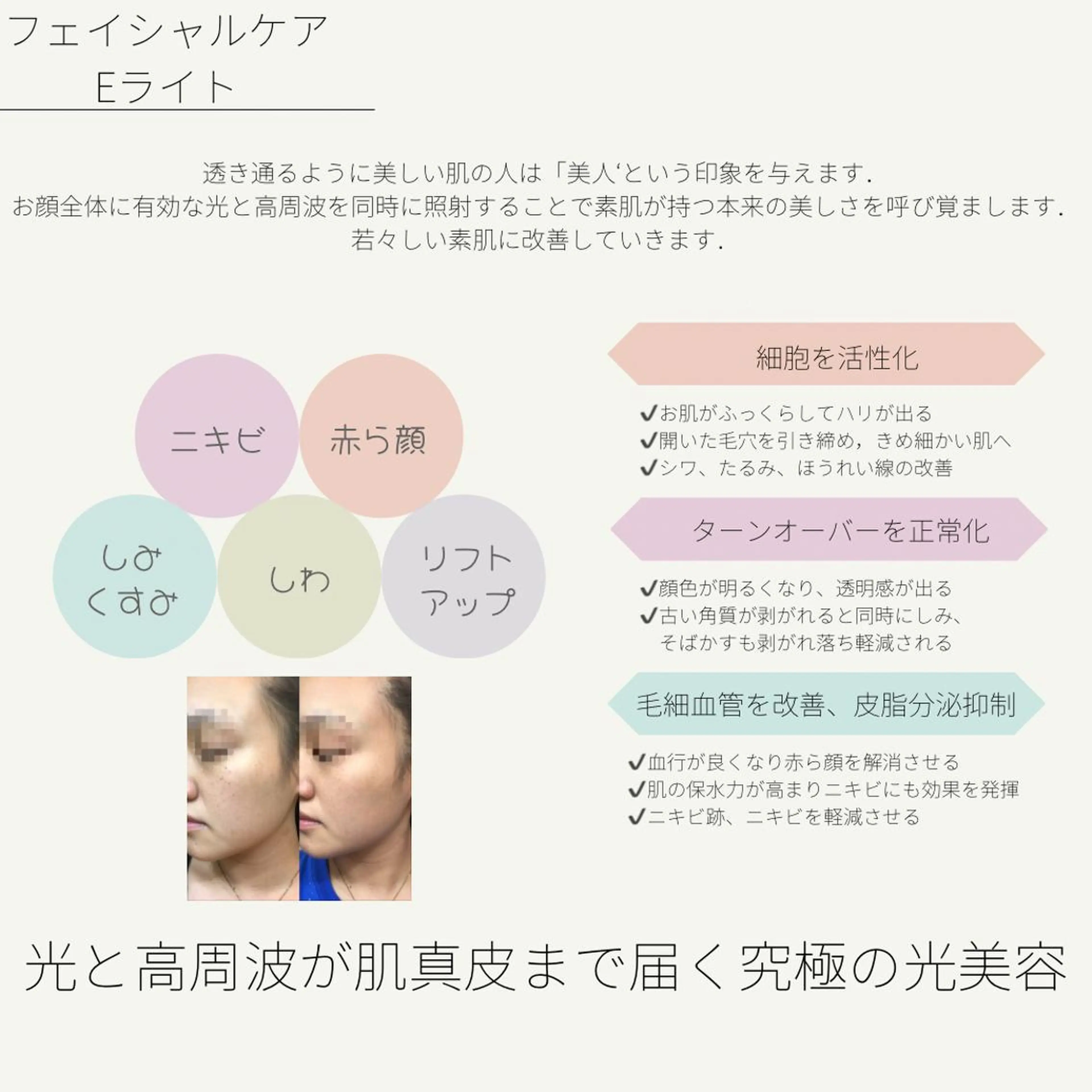 メンズ 栄最安値salon LEPIA内田のエステ・リラクイメージ