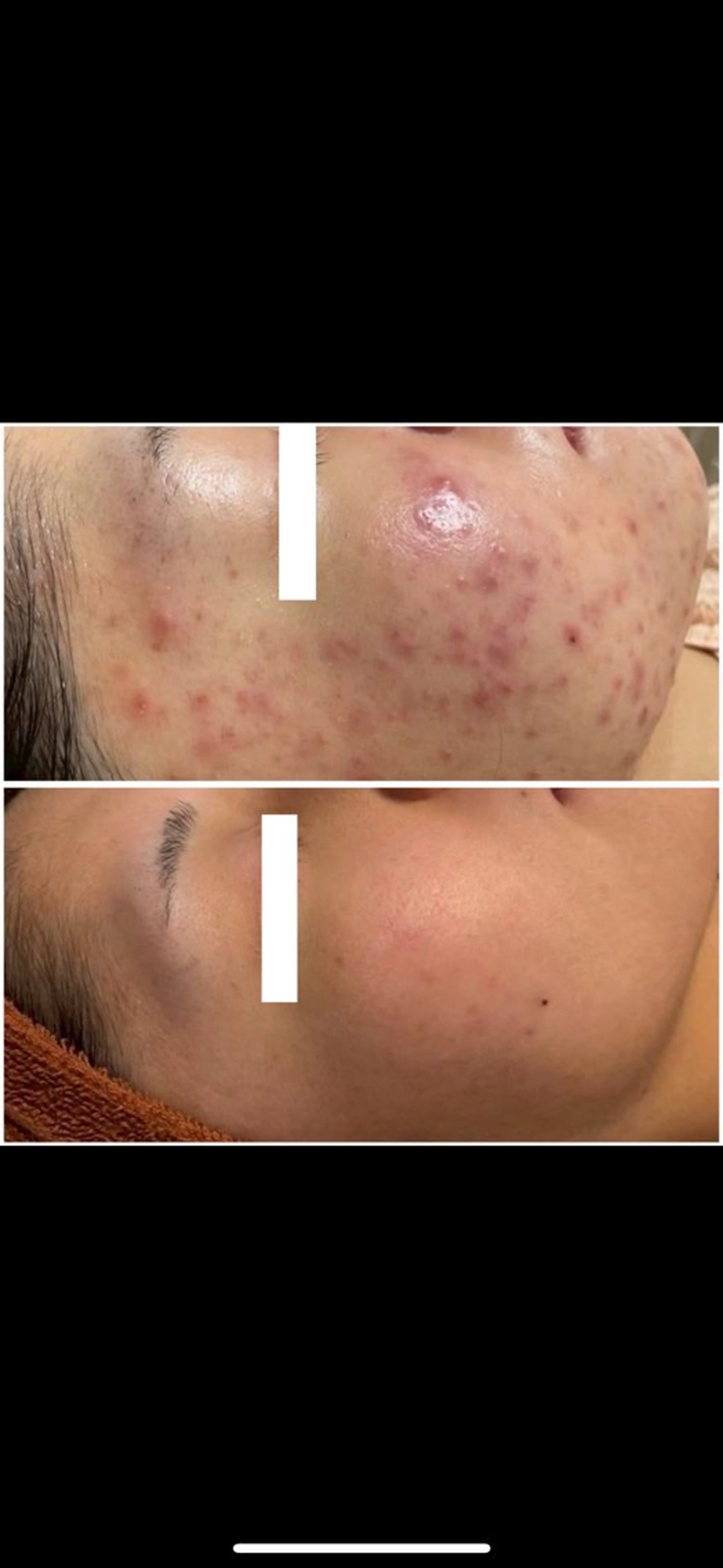 エステ エレファンテブランコ所属・mori yukariのエステ・リラクイメージ