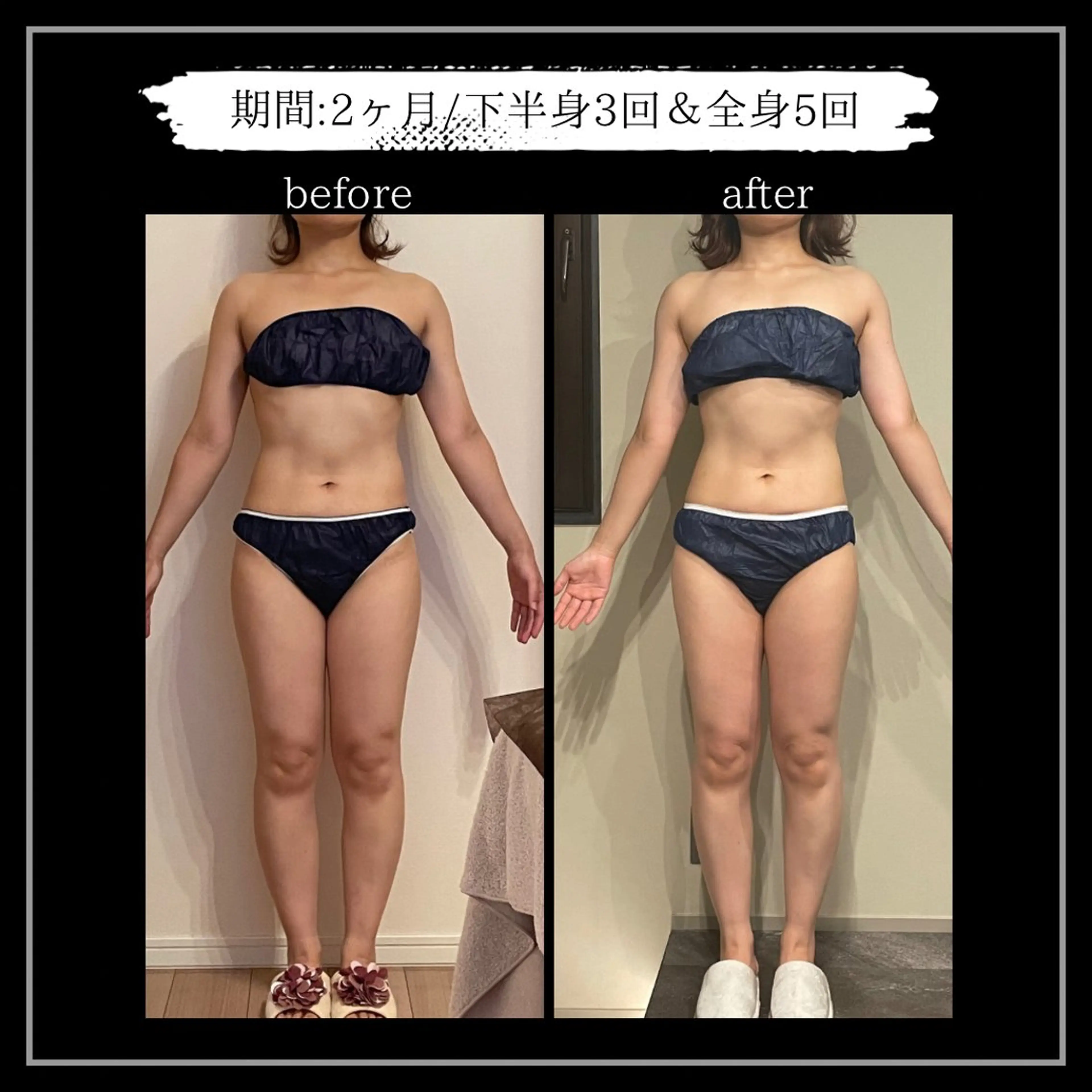 オフ:オン所属・オフ:オン 全身筋膜マッサージのエステ・リラクイメージ