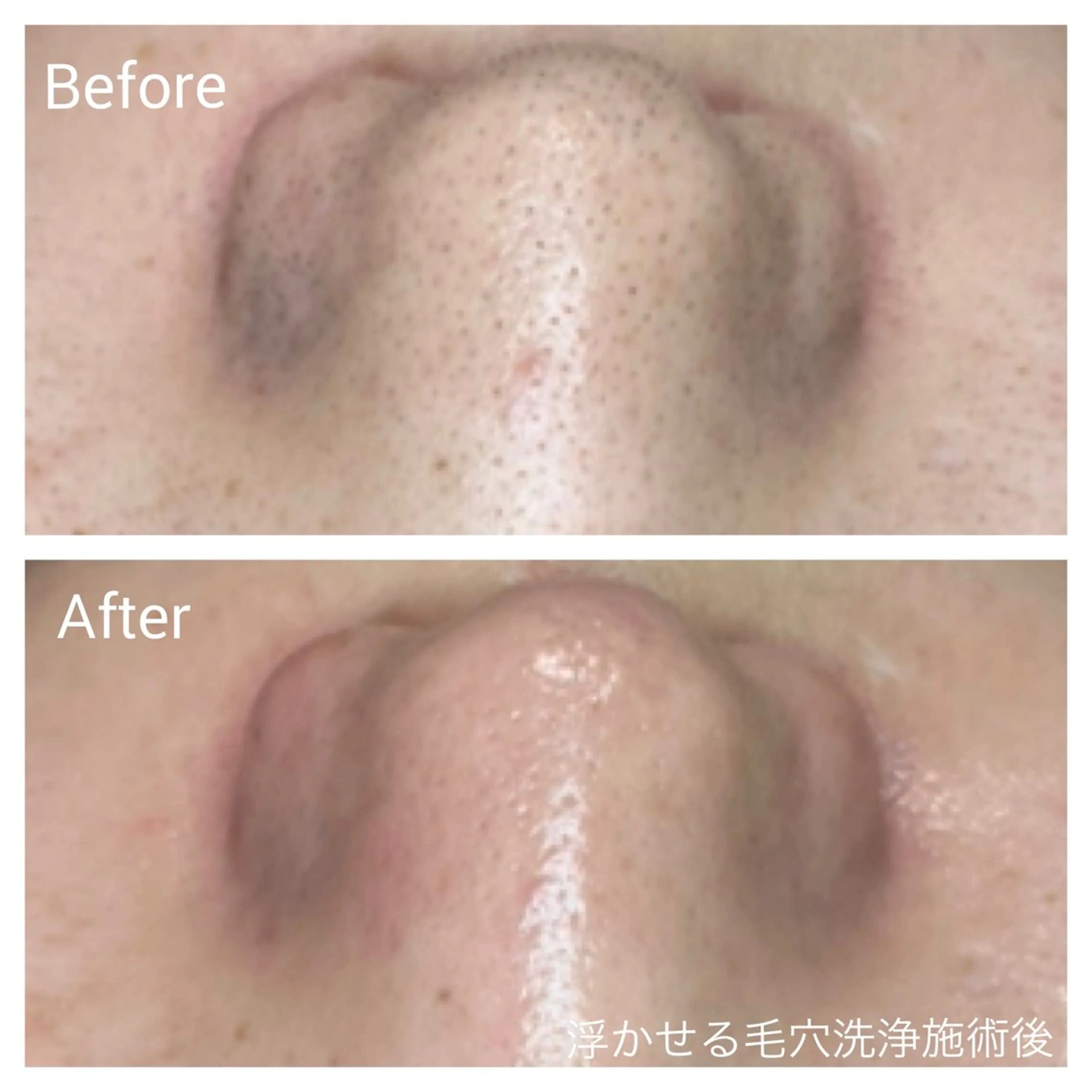 エステ リラク 肌育facial salonのエステ・リラクイメージ