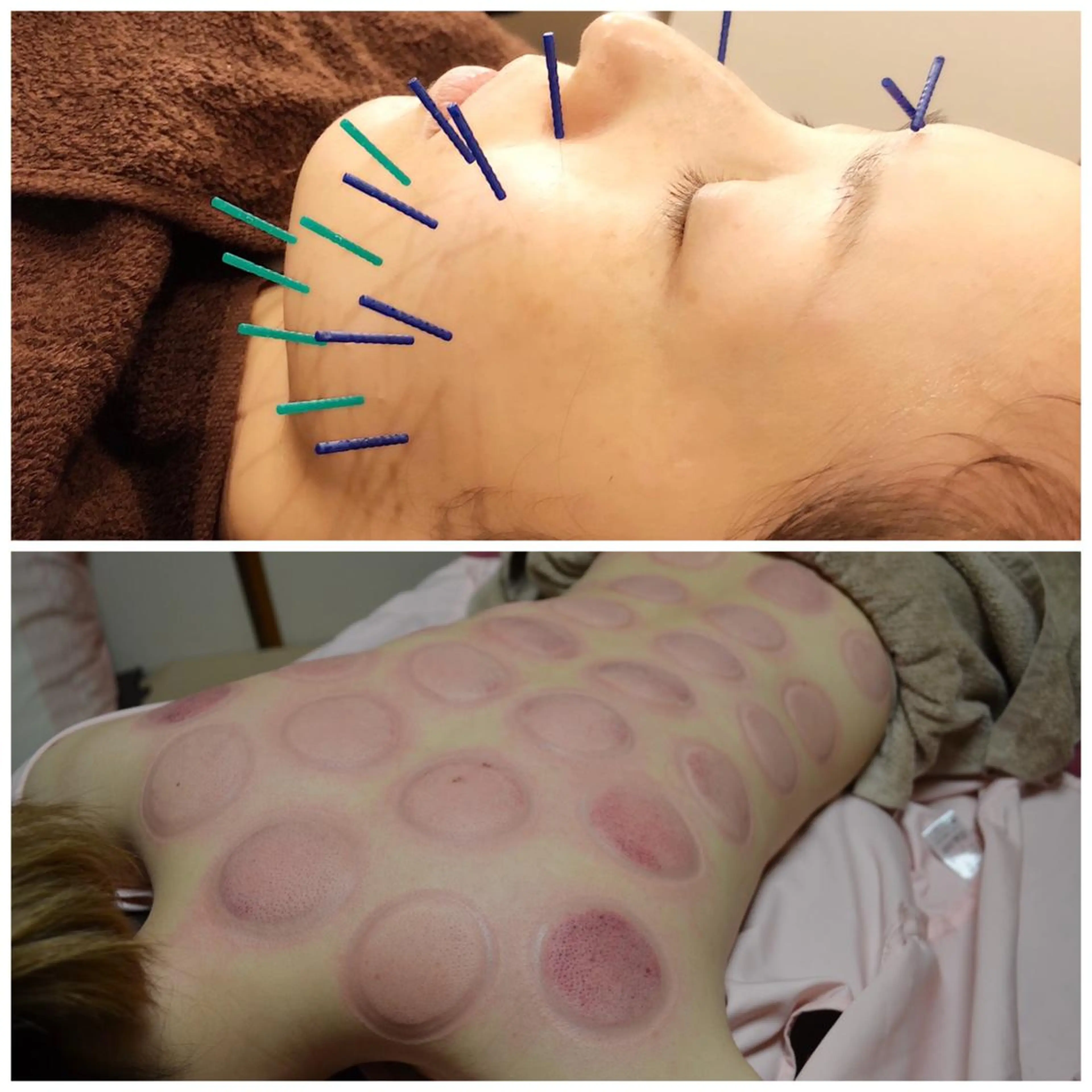 美容鍼灸女性専用 りんご鍼灸治療院のその他イメージ