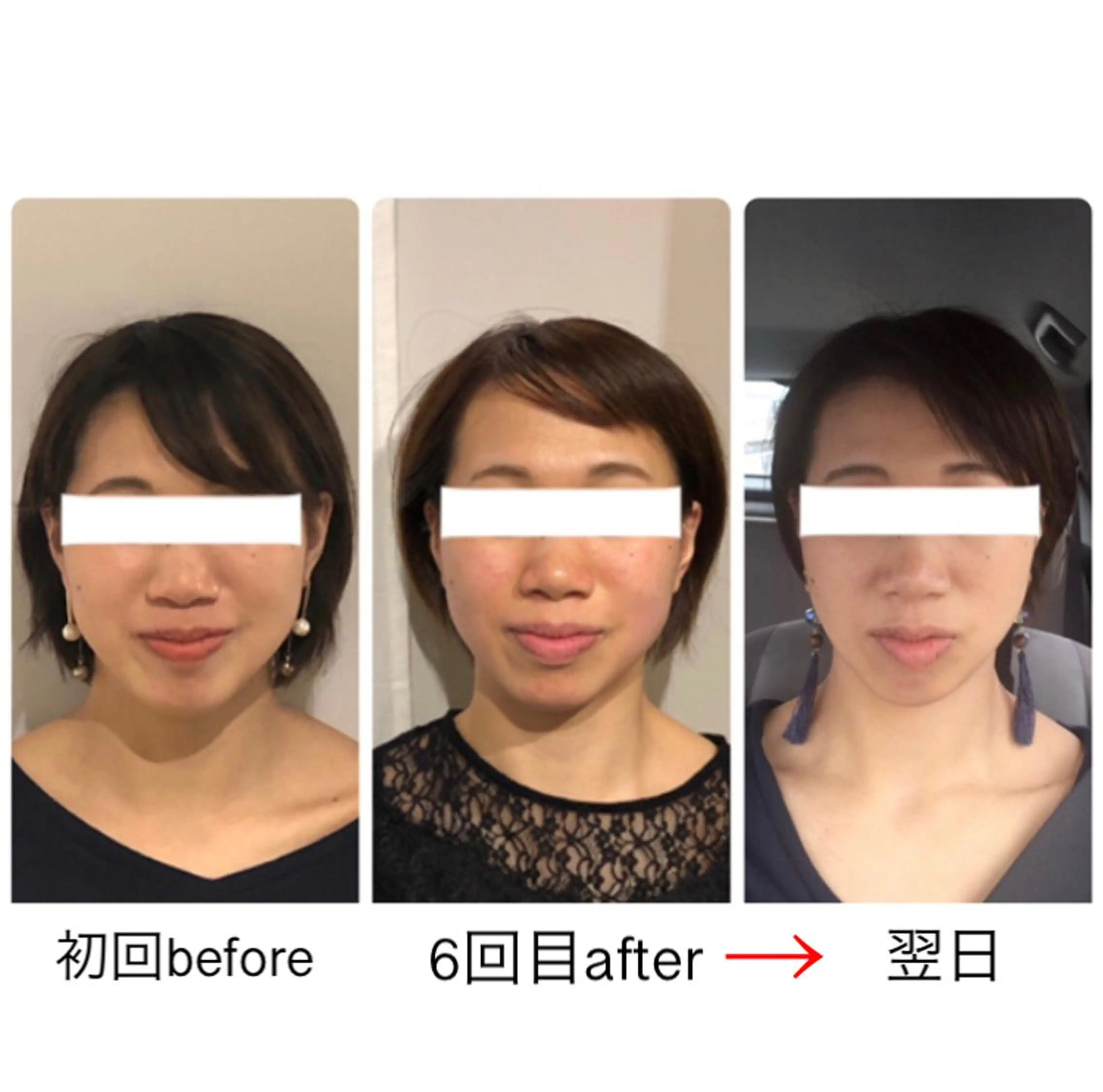 ショート カラー ヘアアレンジ 小顔カット 小顔矯正専門サロンジュマリ所属・町田 淳子のエステ・リラクイメージ
