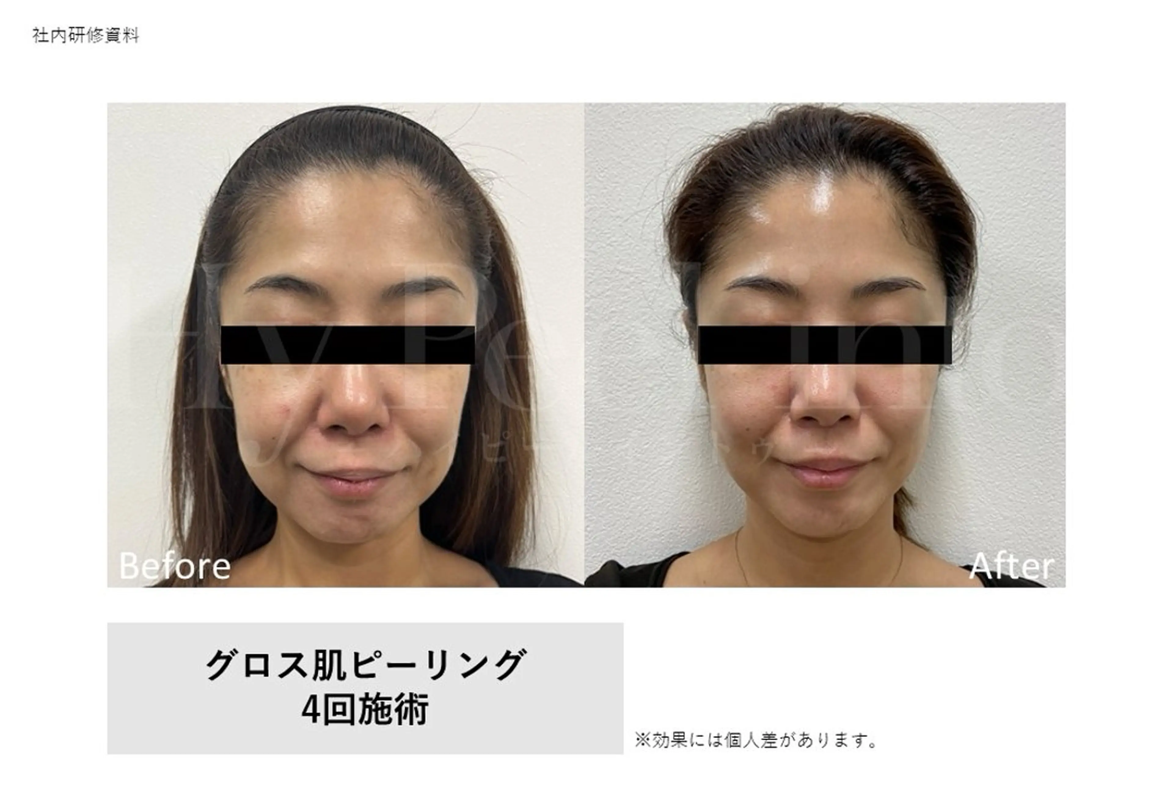 エステ Bellvie beauty salon所属・Bellvie かすみのエステ・リラクイメージ