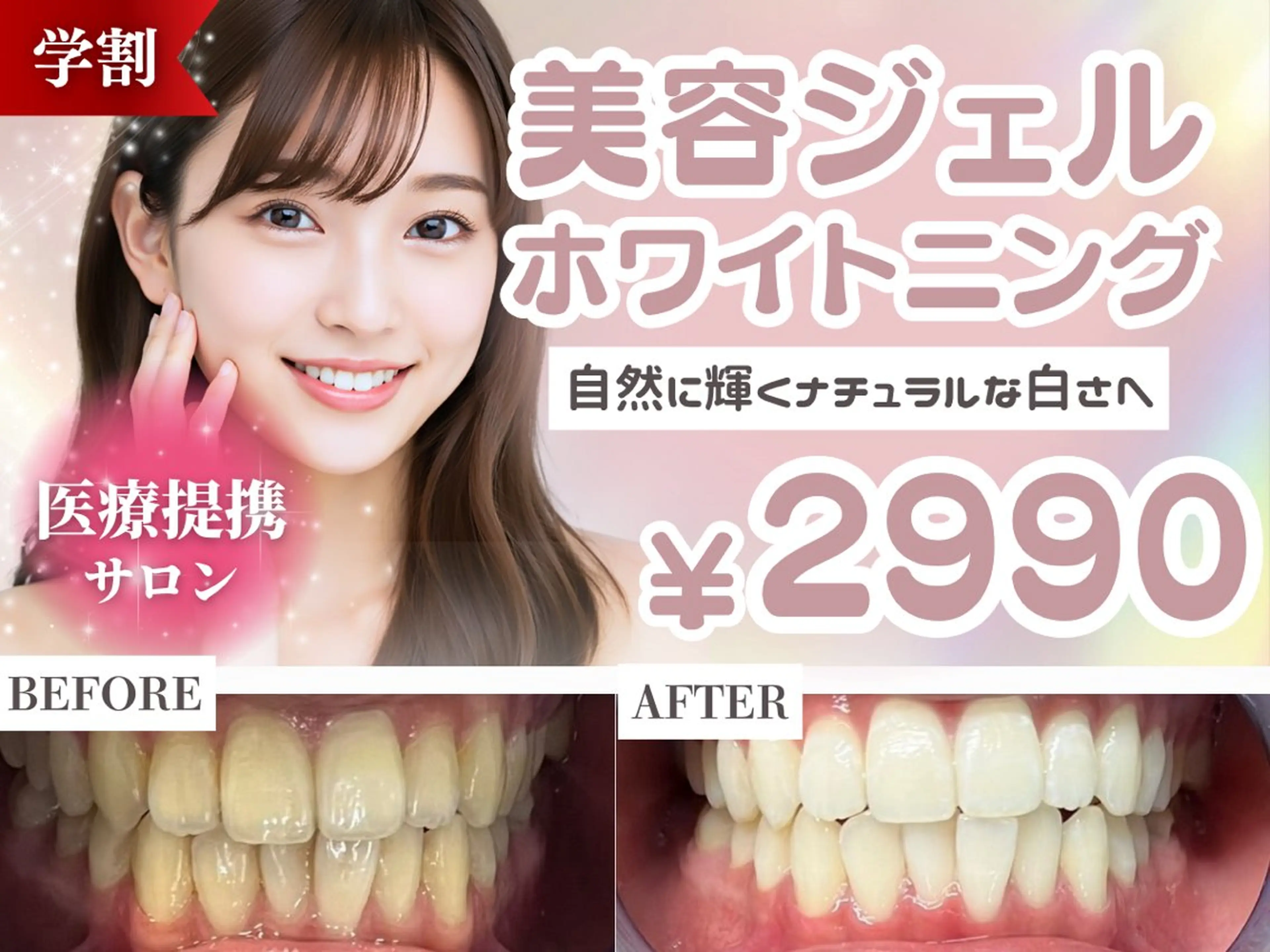 【ミニモ学割】★ラスト10名様限定★お試しホワイトニング美容ジェル15分×4照射の写真