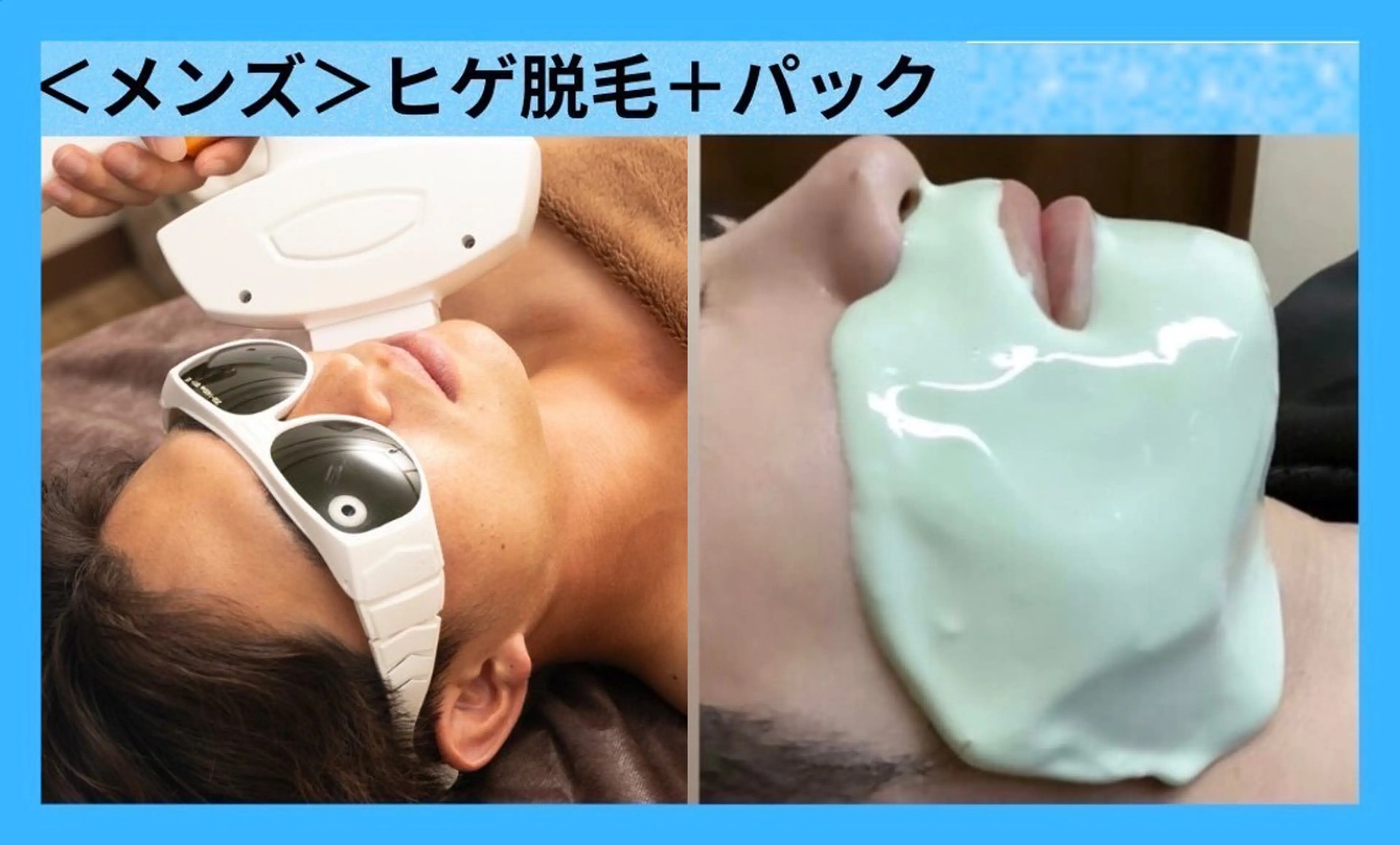【男性脱毛人気No.1】メンズヒゲ脱毛スペシャルパック付 面倒なヒゲ処理なしの写真