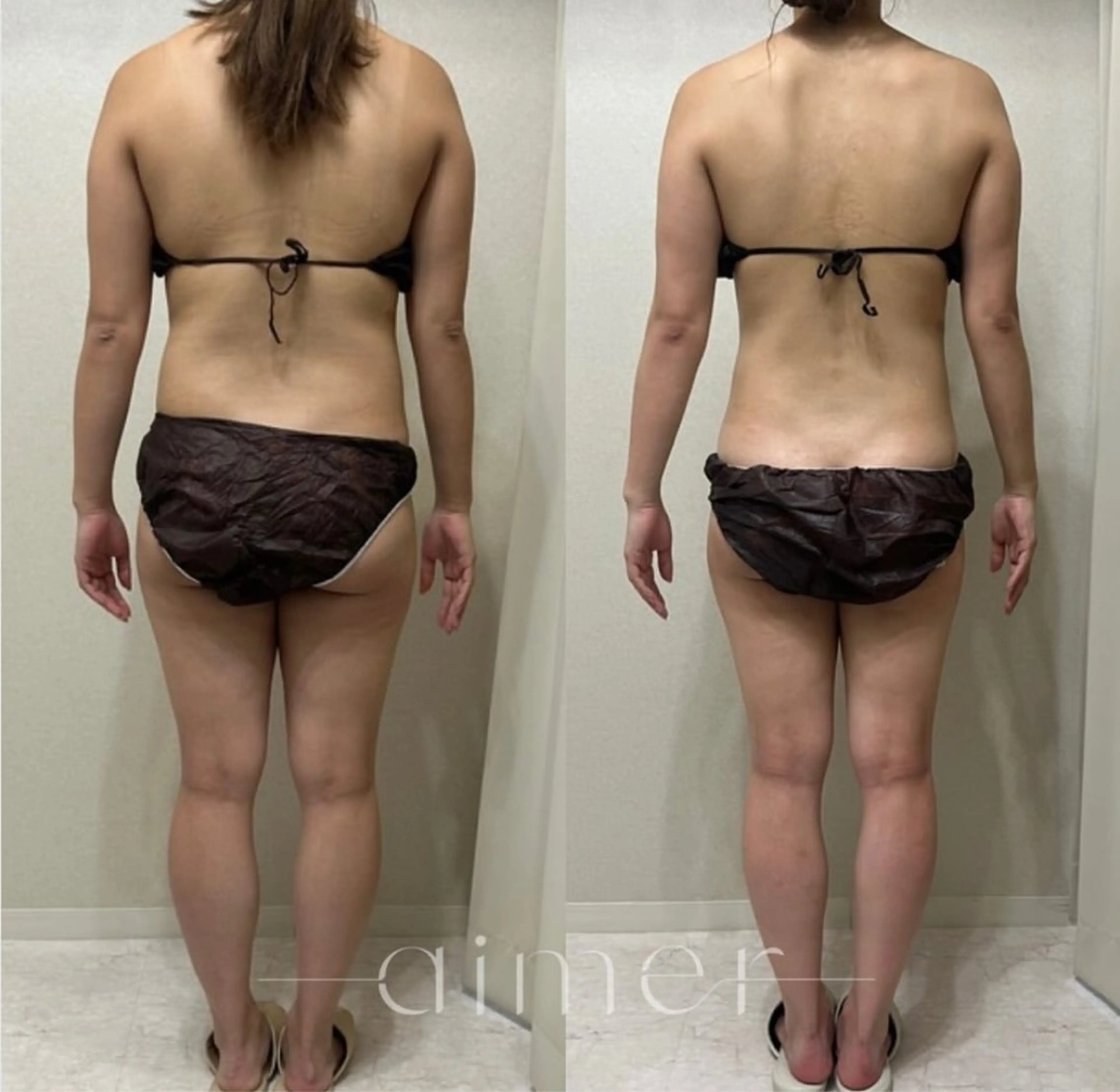 aimer所属・aimer 島田のエステ・リラクイメージ