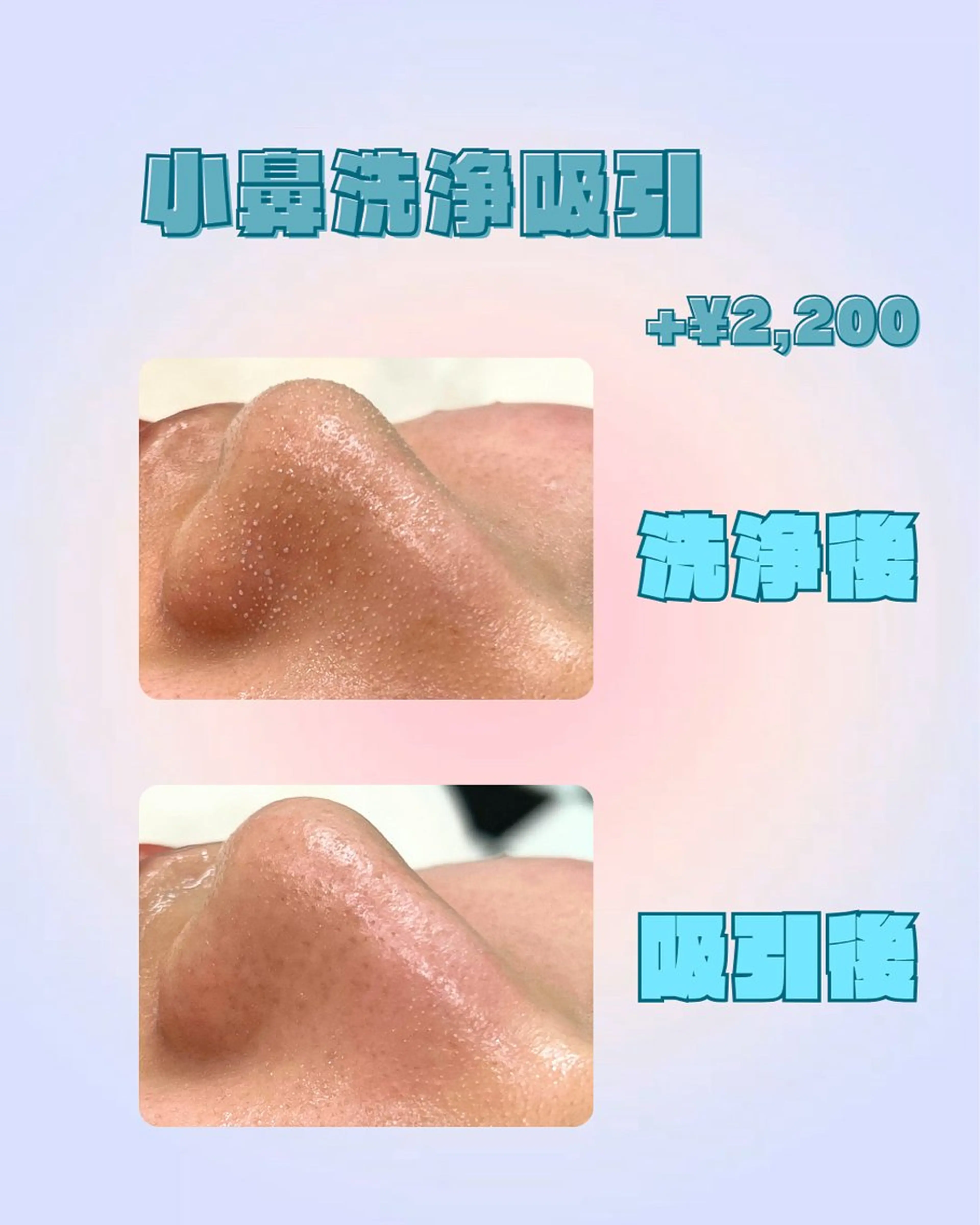その他 🤍艶肌シェービング 🤍清水あみのその他イメージ