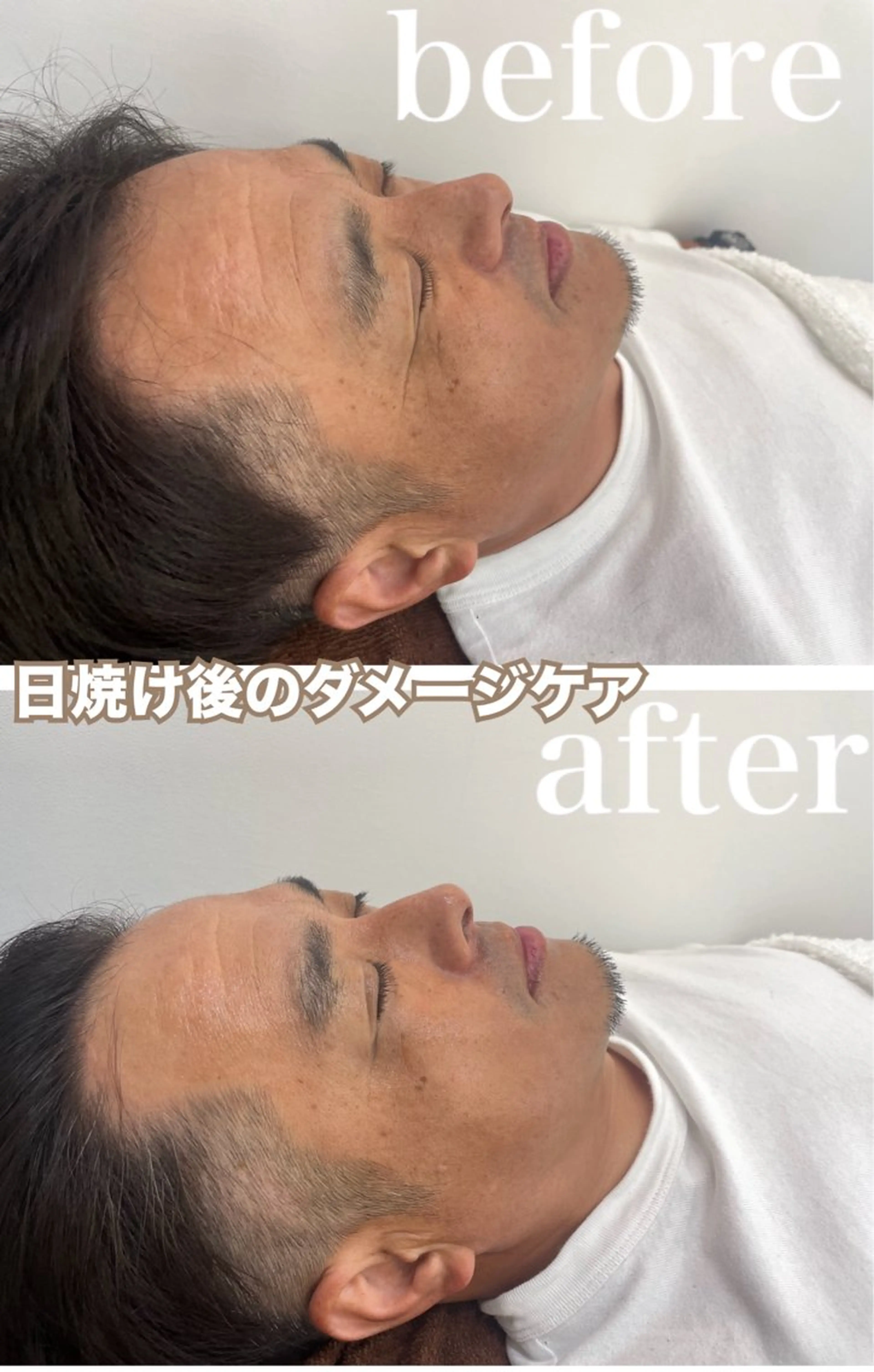 エステ リラク パーソナル肌質改善 🦋APRI🅿️有のエステ・リラクイメージ