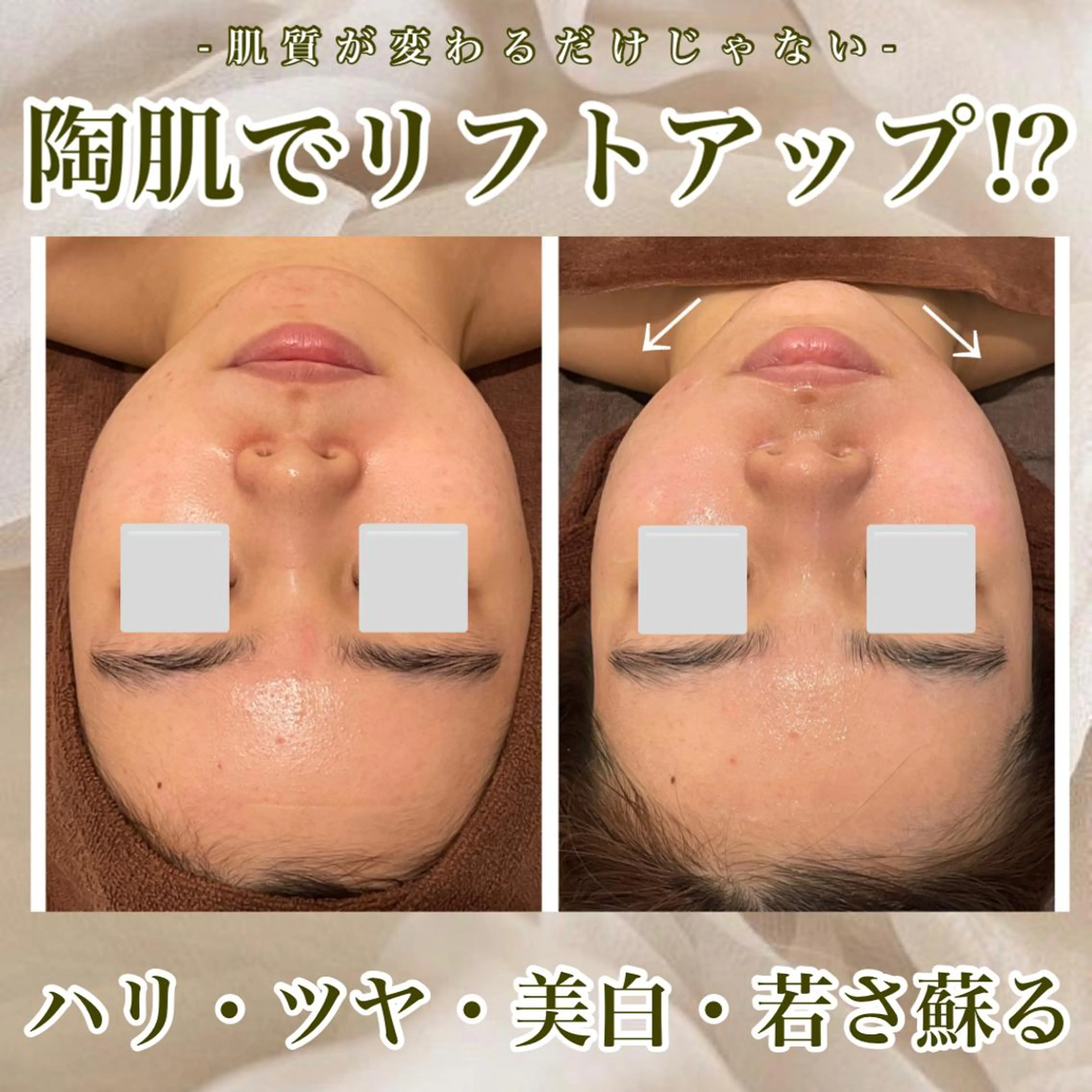 エステ Meow！～トラブル肌専門ピーリング＆脱毛サロン～所属・トラブル肌改善🏥 Meow！🫧🫧のエステ・リラクイメージ