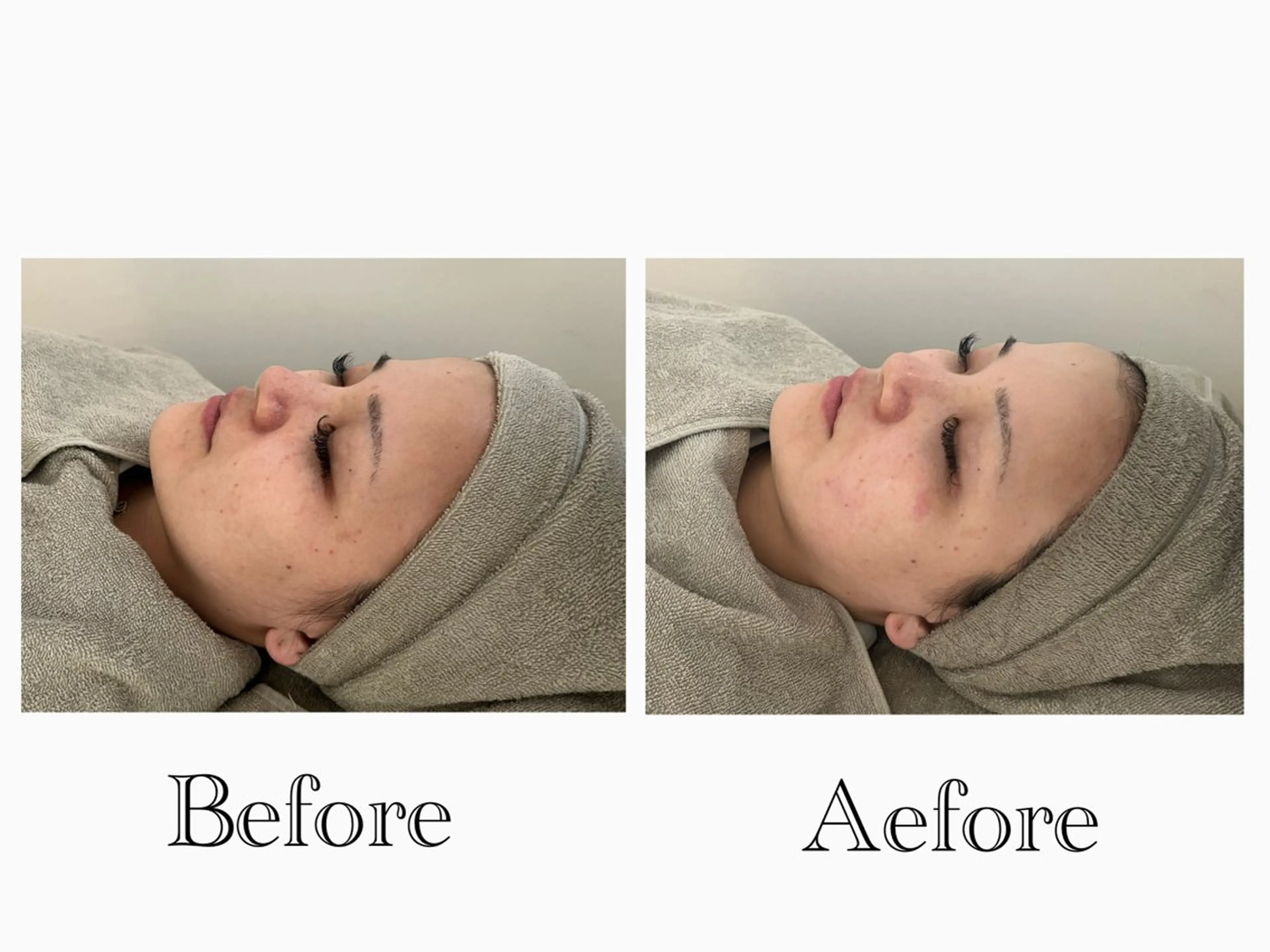 人気No1👑(60分)【小顔/むくみ/乾燥/肌荒れ】オールハンドで優しくマッサージ➕ソフトシェービングで産毛ケアの写真