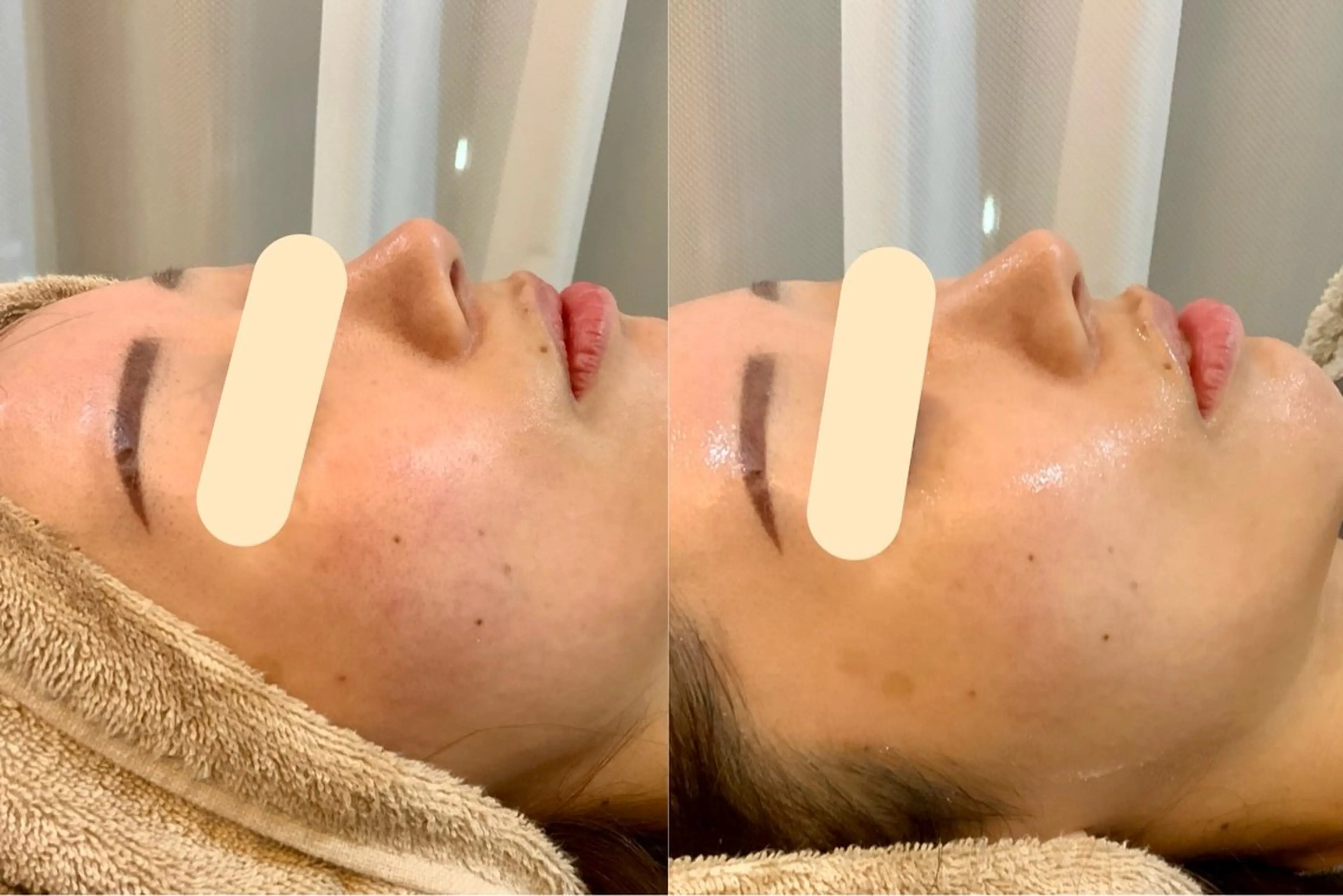 エステ 小顔・肌質改善 espoir 心斎橋のエステ・リラクイメージ