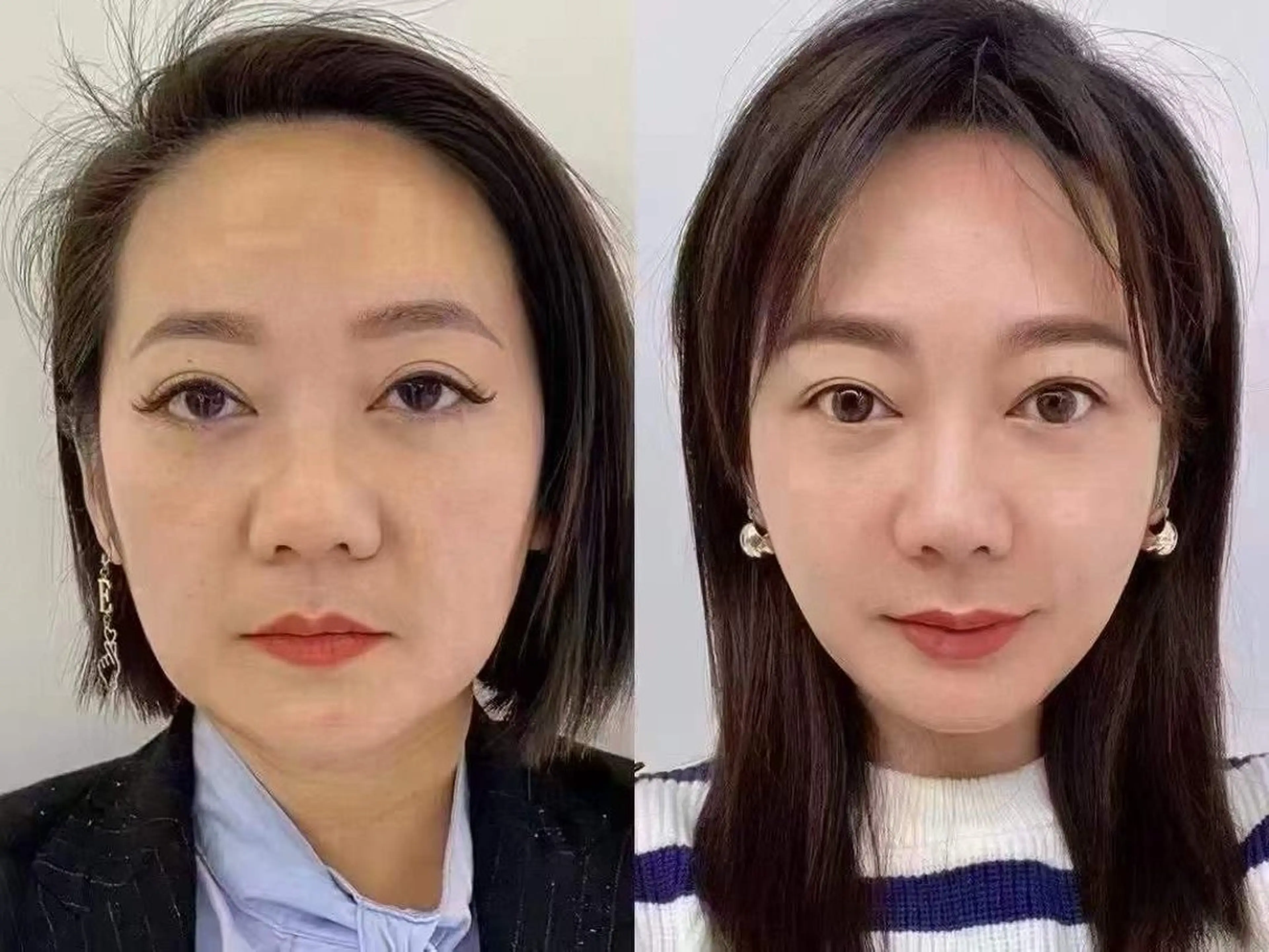 マツエク・マツパ 結婚式・ブライダル エステ aliaハイフ&水光ジェットサロン所属・aliaハーブ水光店 エステティシャン募集のエステ・リラクイメージ