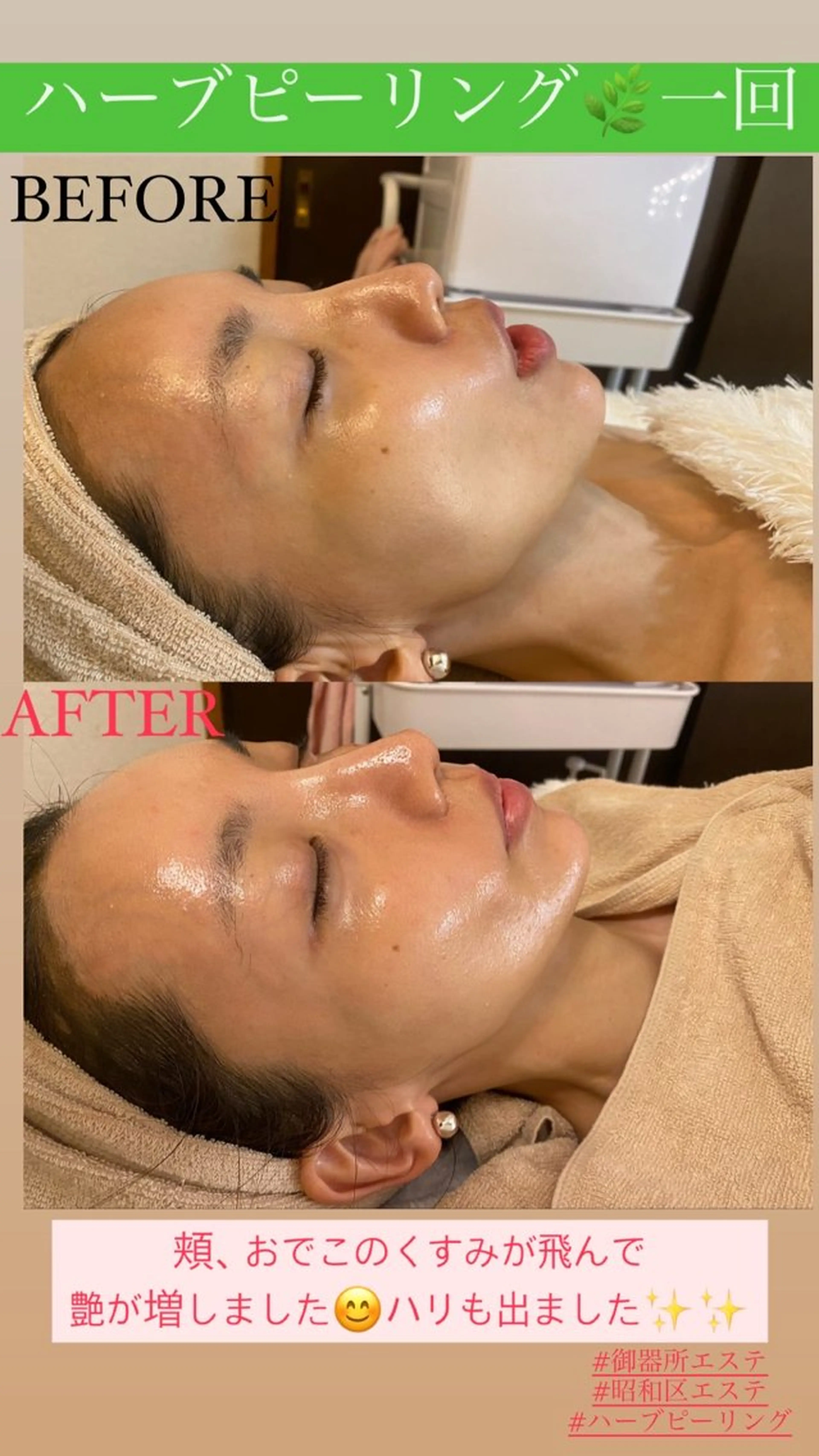 エステ Salon de Lino 御器所のエステ・リラクイメージ