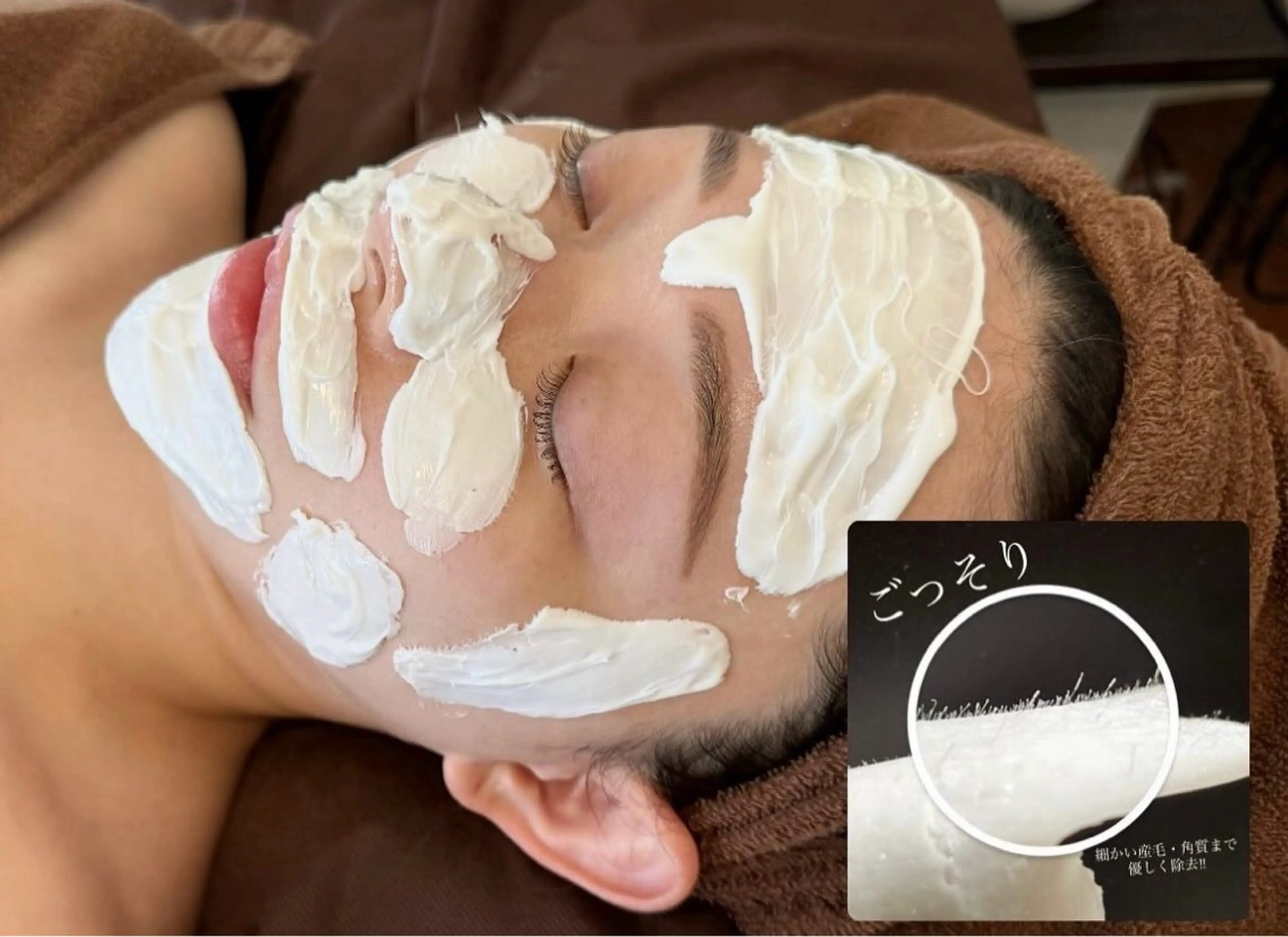 【天使の艶爆弾】艶肌Wax+高濃度美容液+エピダームパック鎮静付の写真