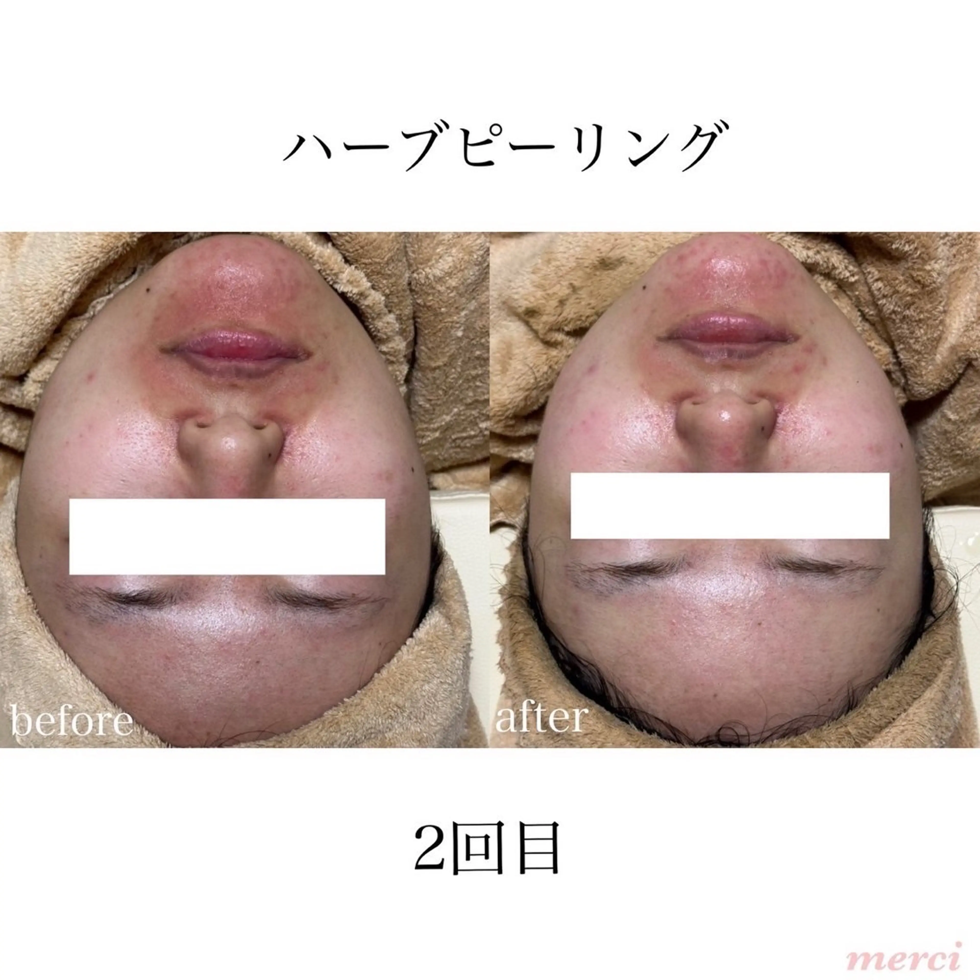 salon merciのエステ・リラクイメージ