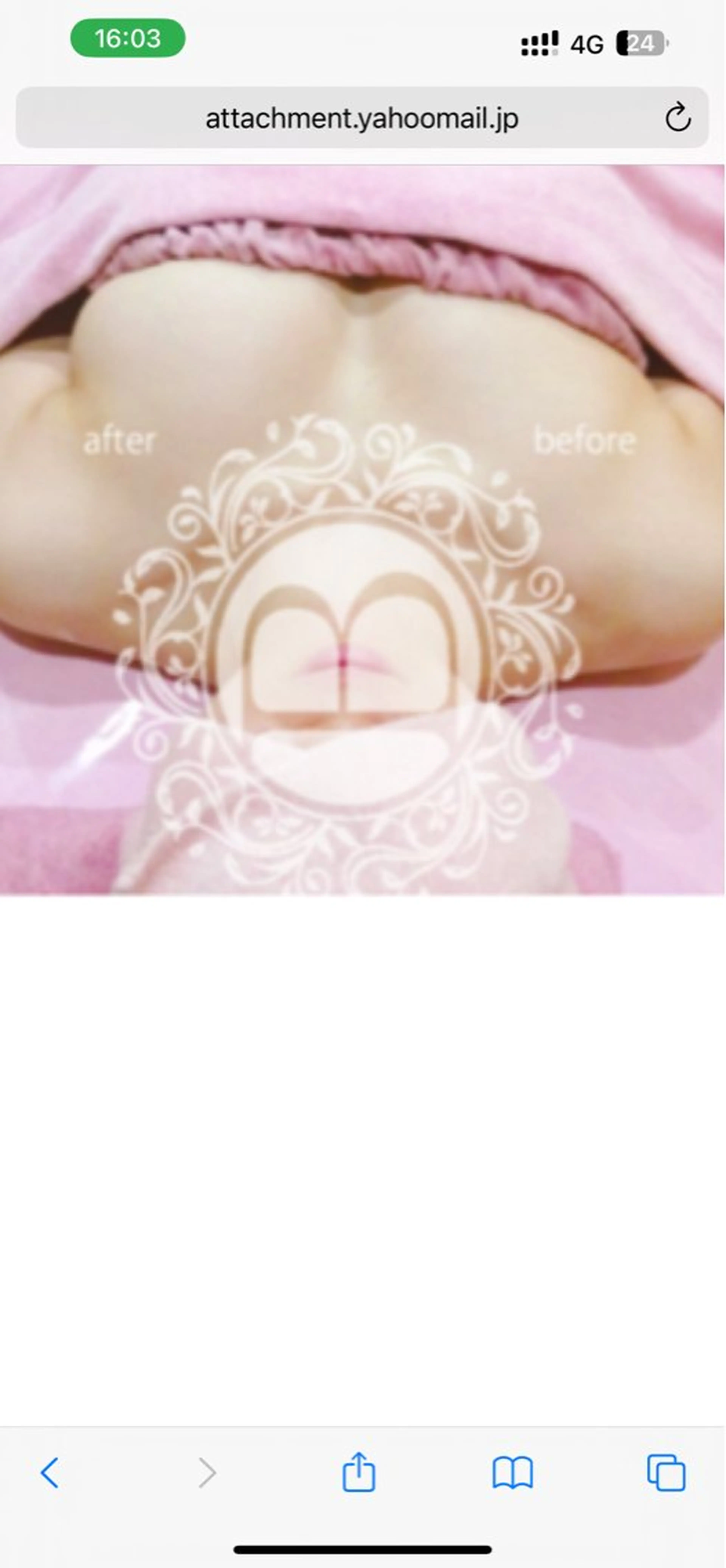 ミラクルバストプレミアムコースの写真