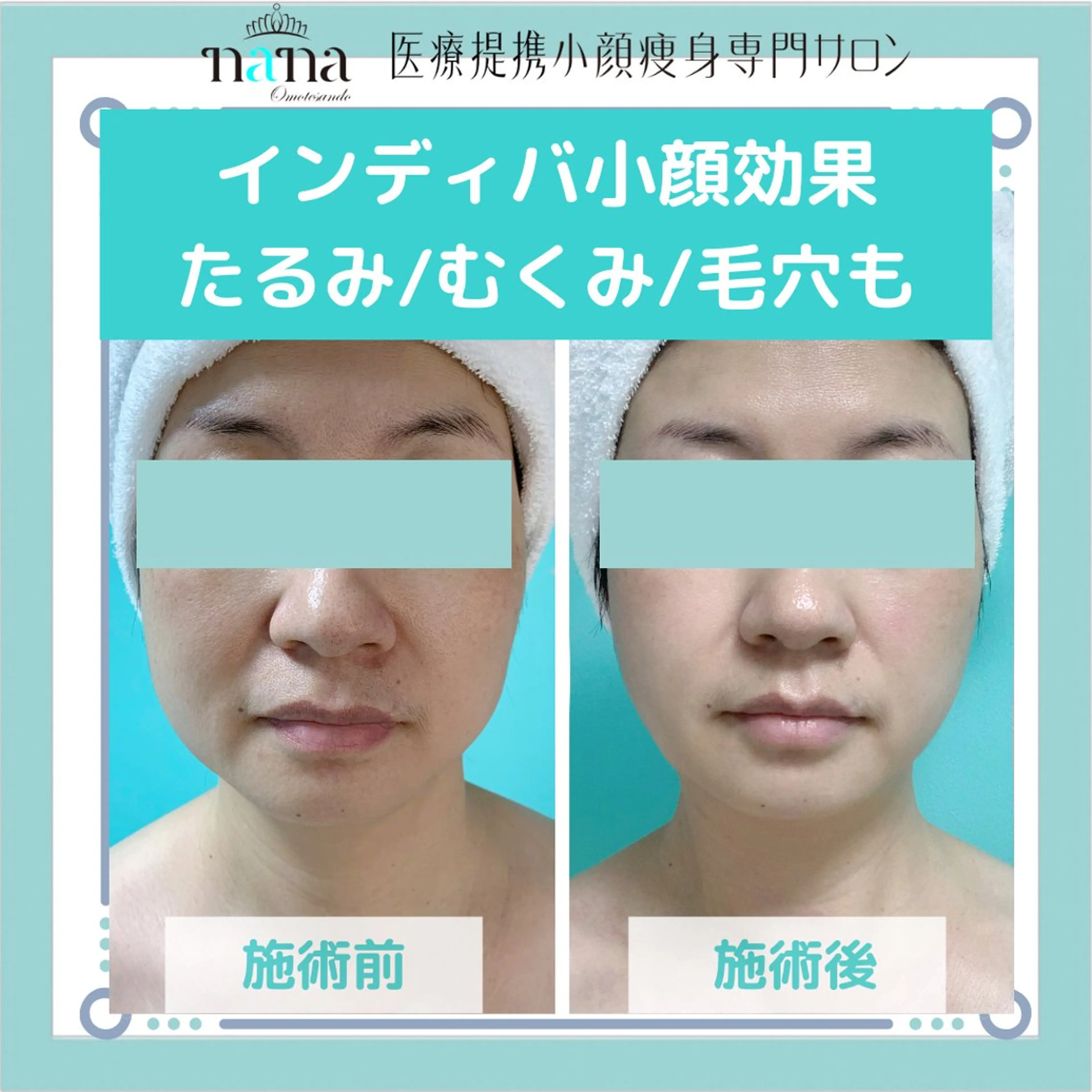 エステ リラク 小顔痩身インディバ Nana表参道のエステ・リラクイメージ