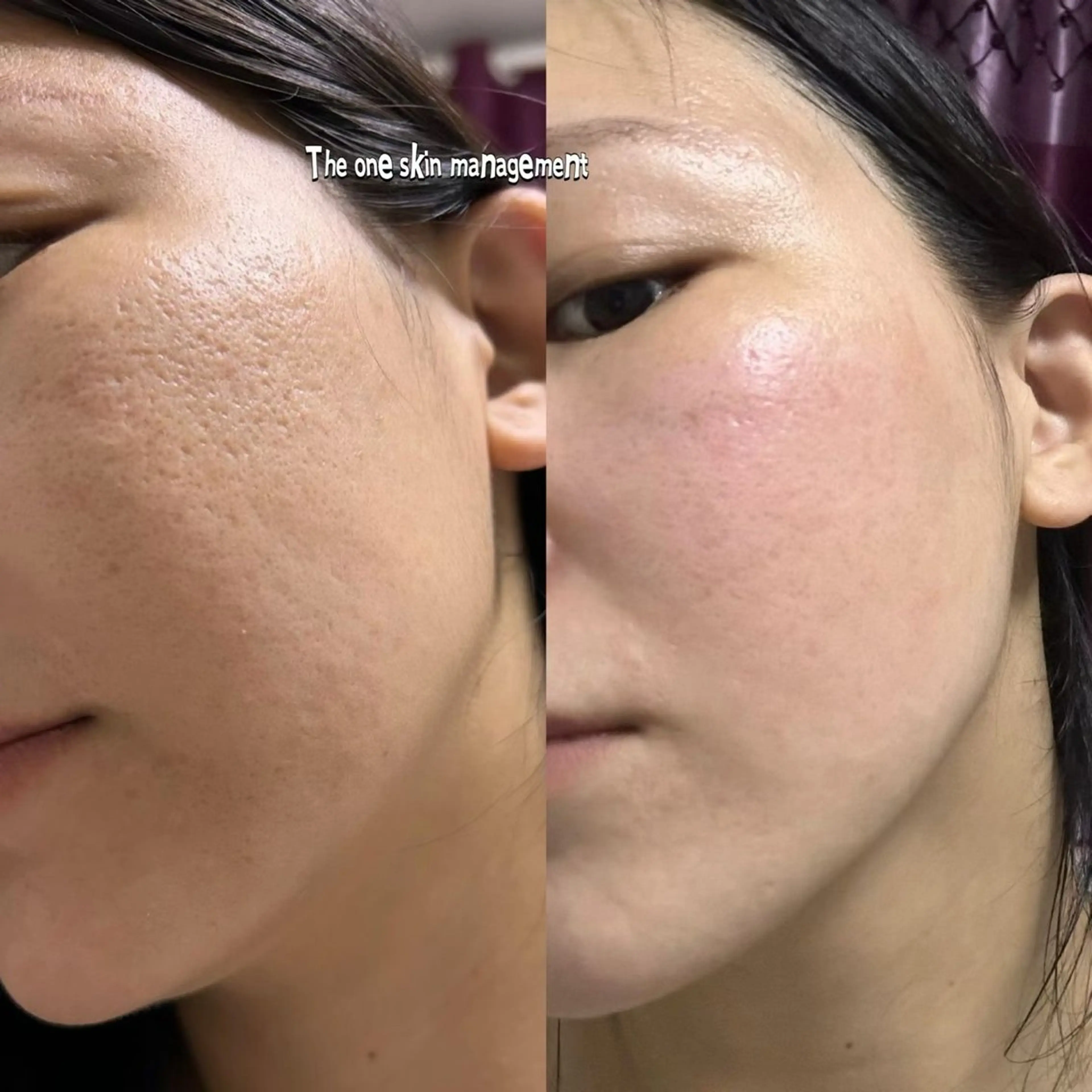 アイブロウ エステ aliaハイフ&水光ジェットサロン所属・aliaハーブ水光店 エステティシャン募集のエステ・リラクイメージ