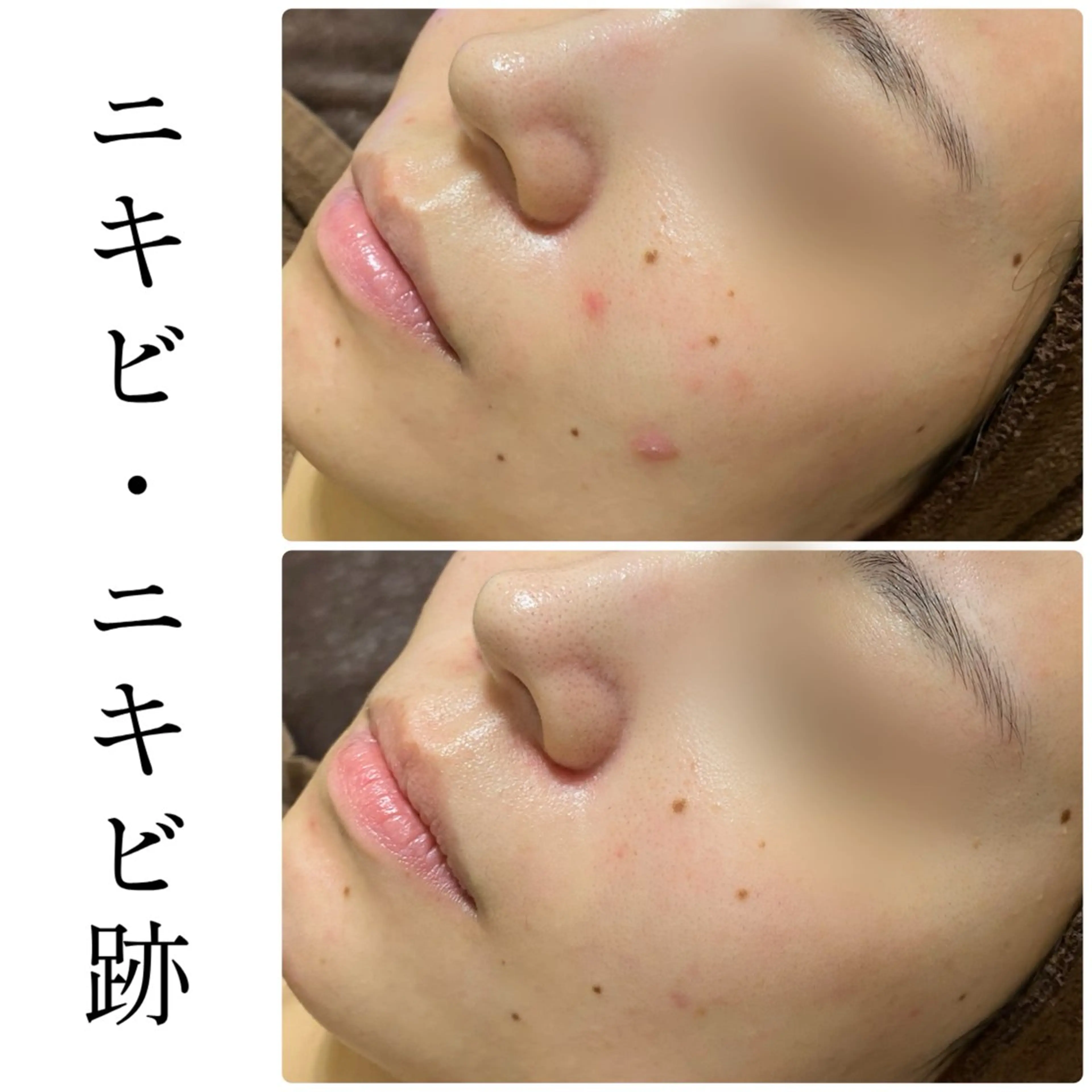 エステ ハーブピーリング専門 BIOEL横浜のエステ・リラクイメージ