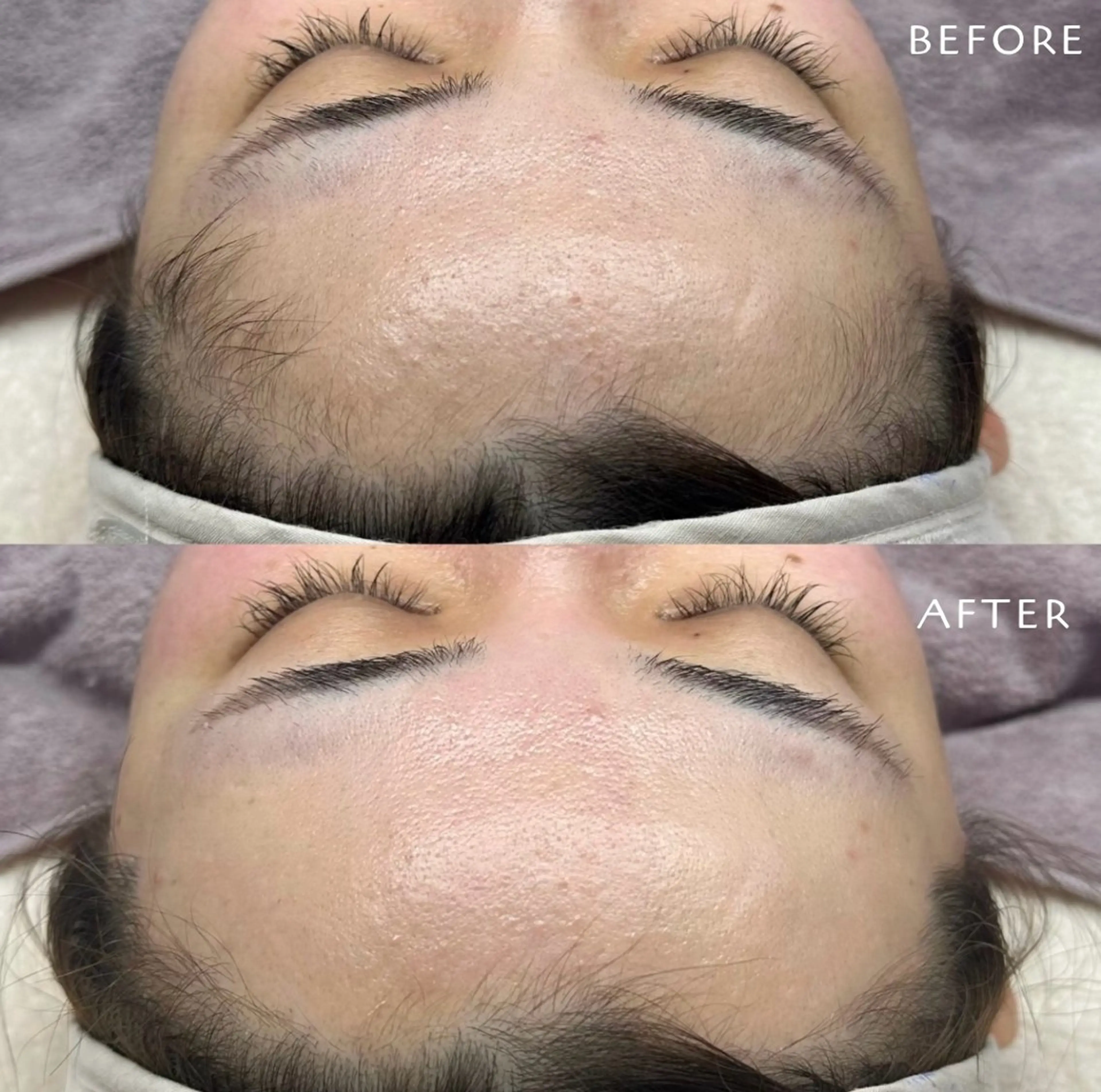 脱毛 フェイシャルワックス KANAKOのエステ・リラクイメージ