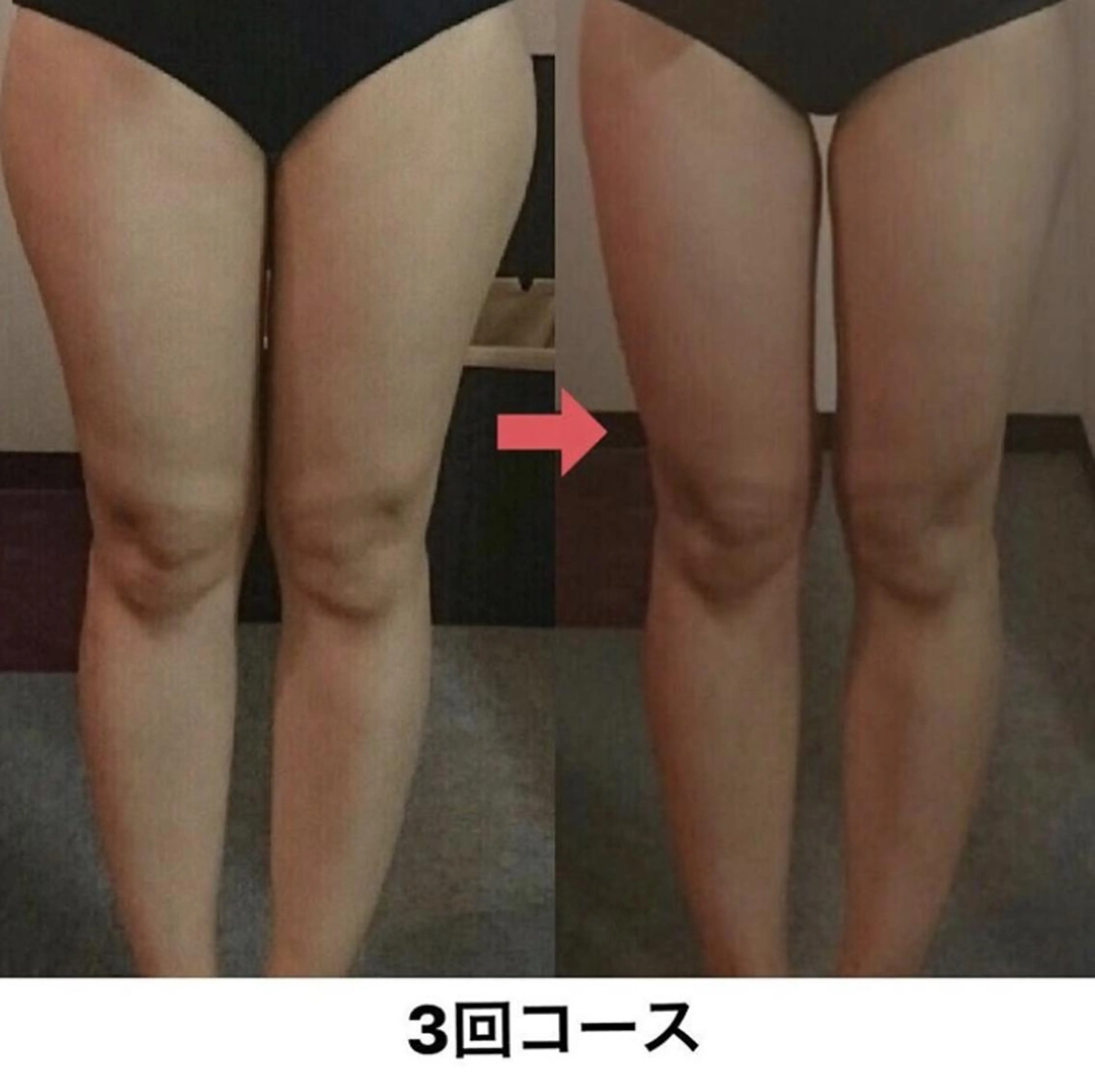 横浜エステサロン R-ing リングのエステ・リラクイメージ