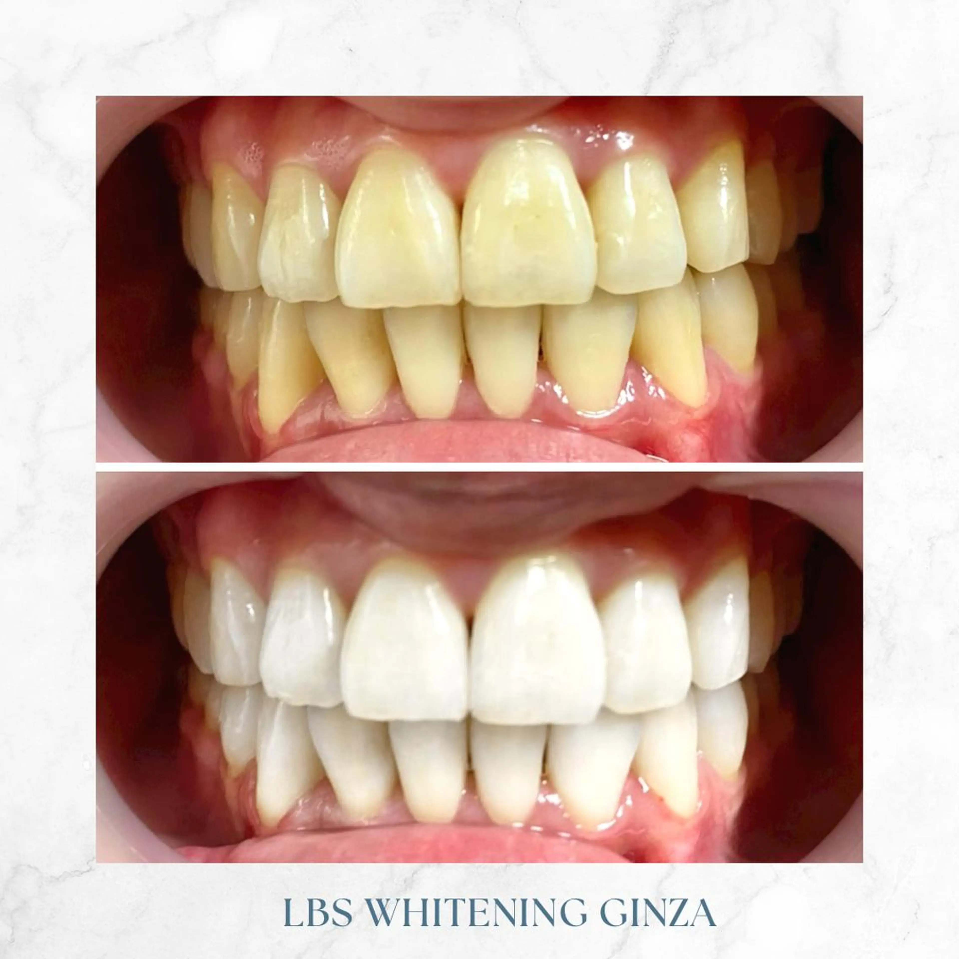 メンズ エステ リラク LBSホワイトニング 銀座店💎公式のその他イメージ