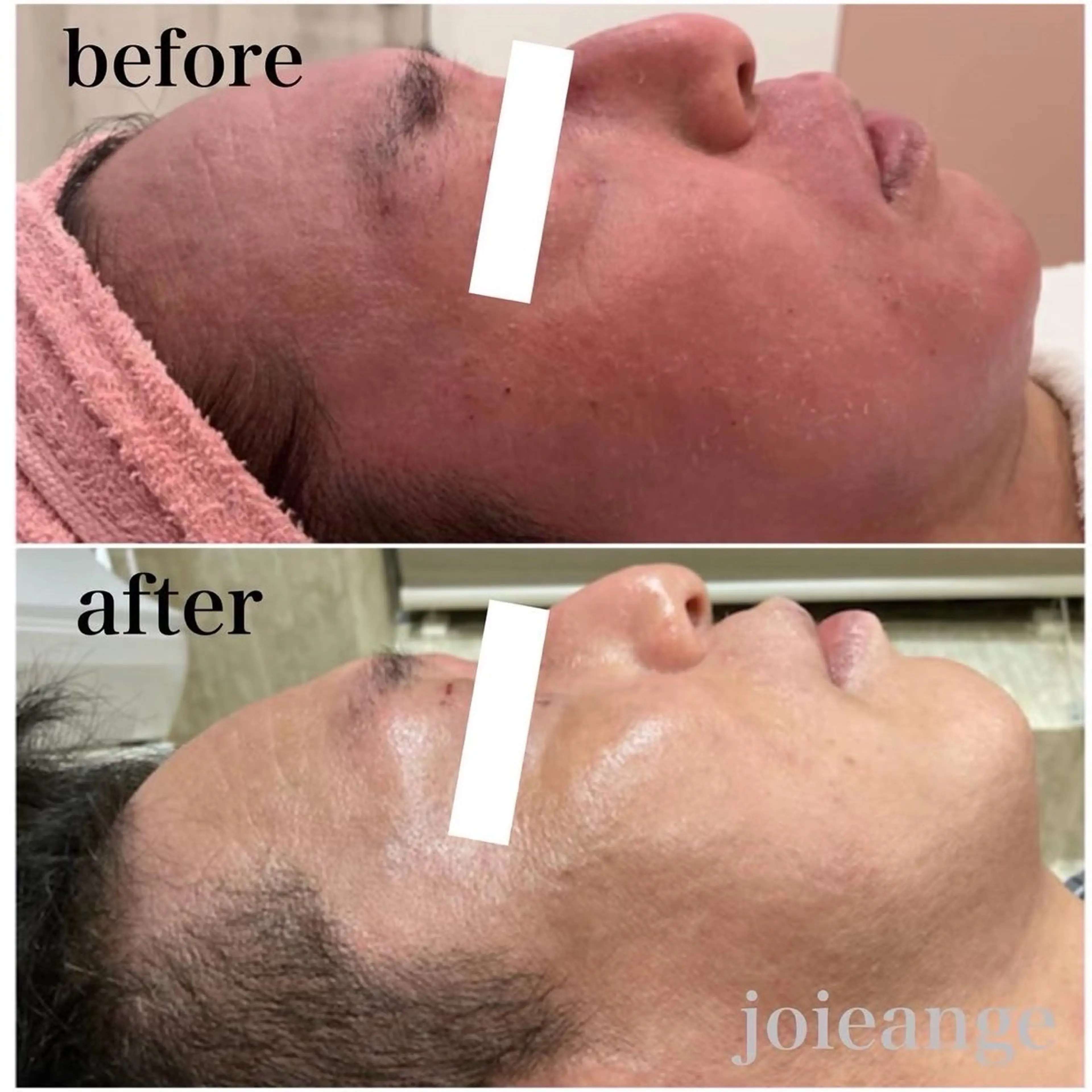 エステ フェイシャル/脱毛 ジョアアンジェ竹田のエステ・リラクイメージ