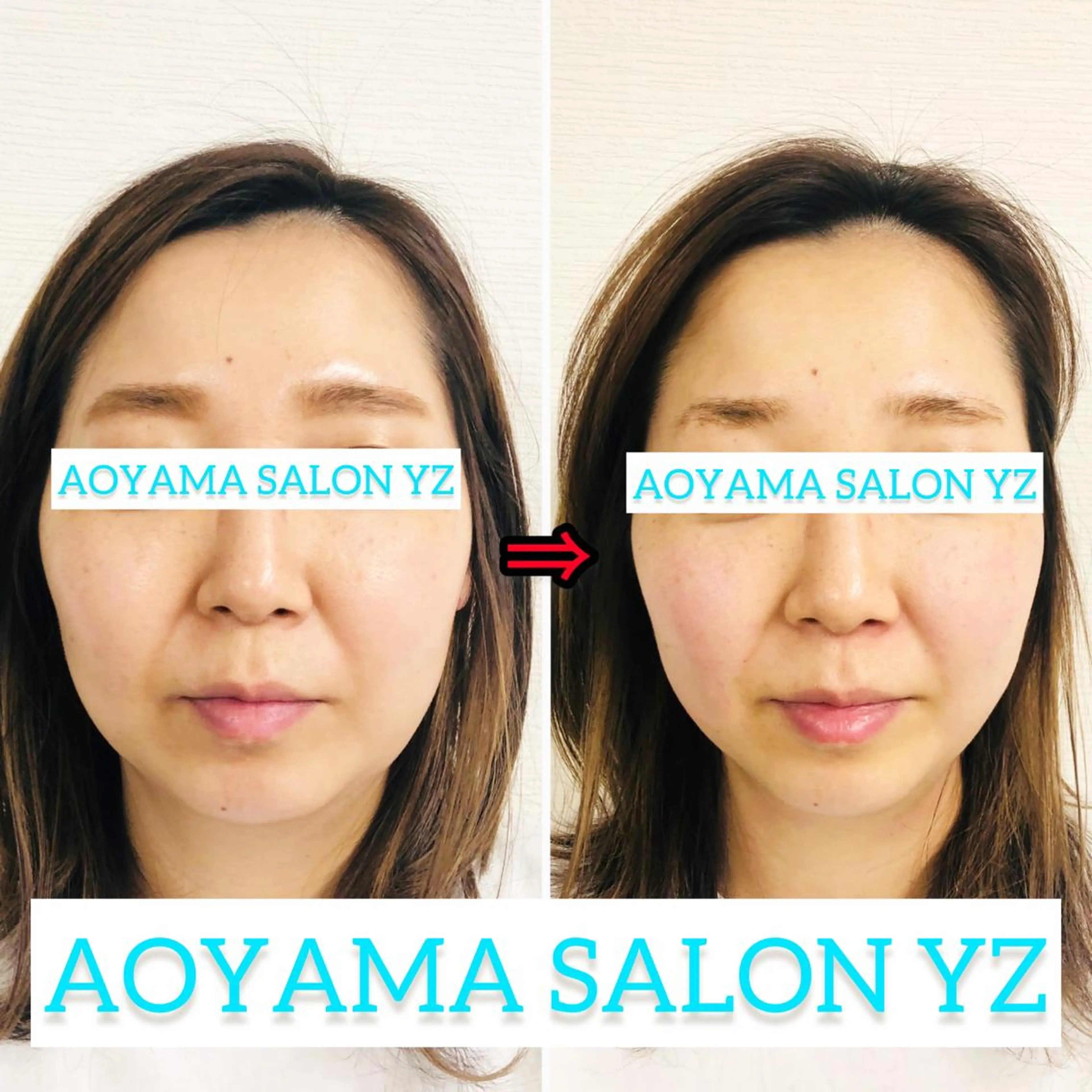 小顔美容鍼専門サロン 渋谷YZのエステ・リラクイメージ