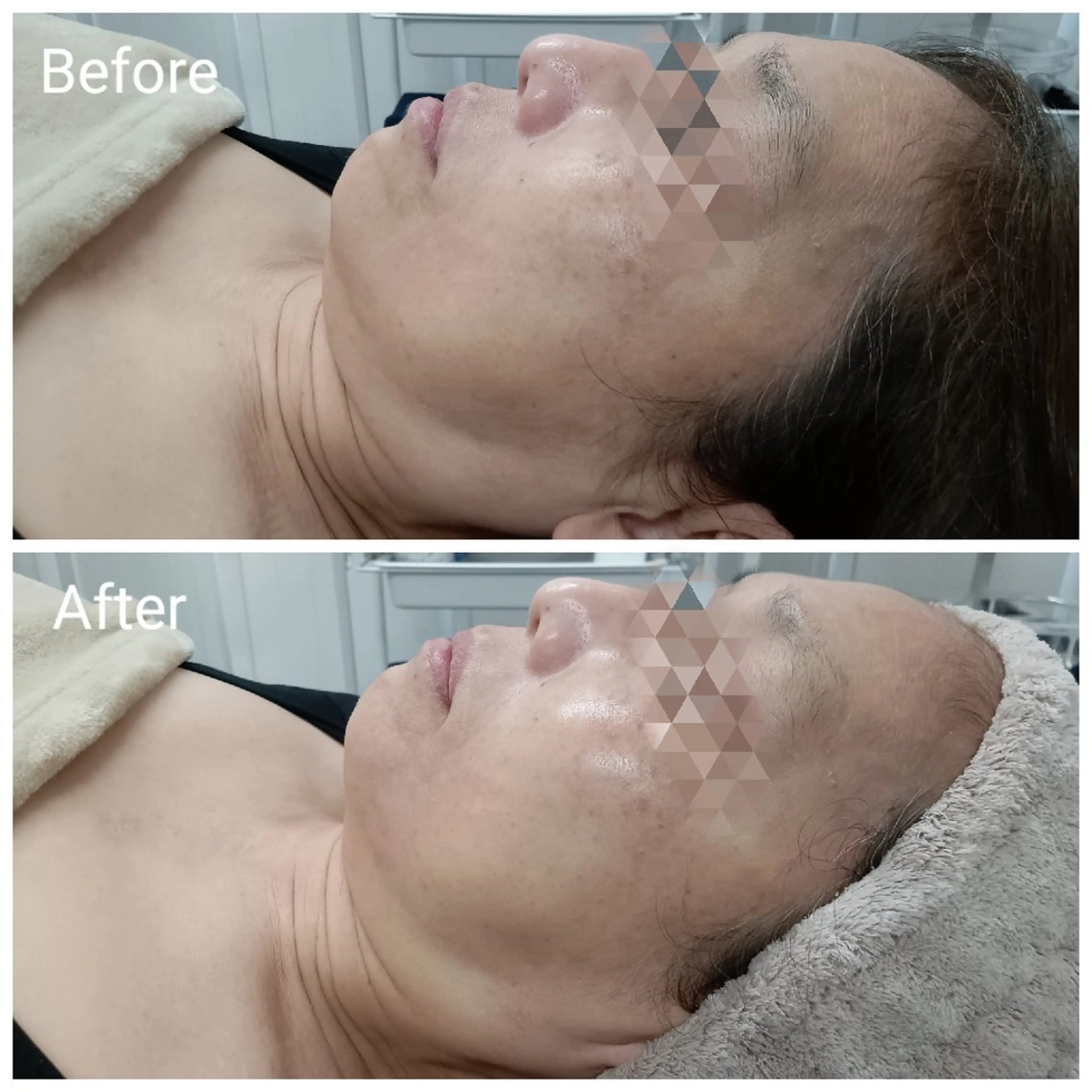 エステ リラク 肌質改善Beauty salon Renのエステ・リラクイメージ