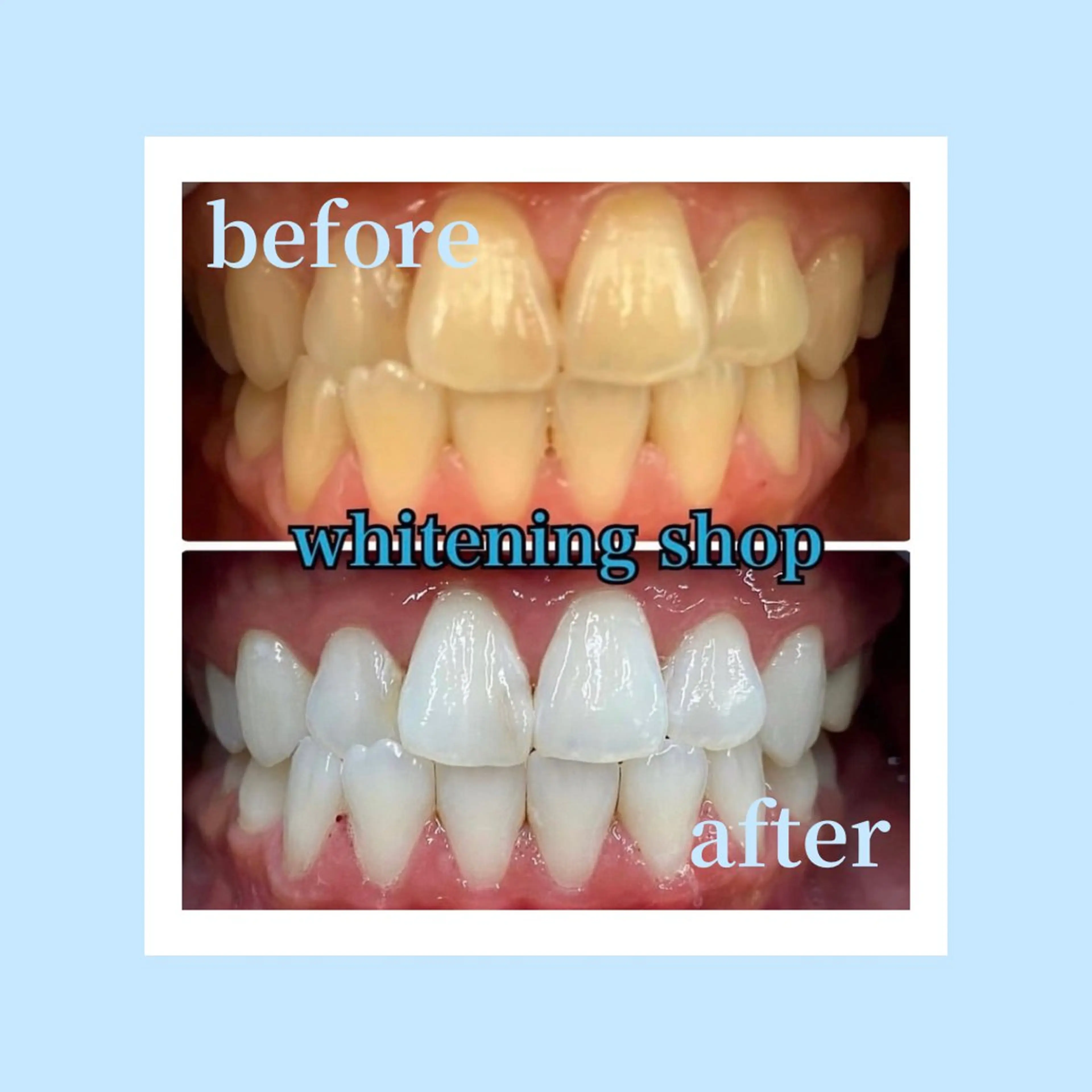 ホワイトニングショップ光明池店所属・ホワイトニング ショップ光明池店のエステ・リラクイメージ