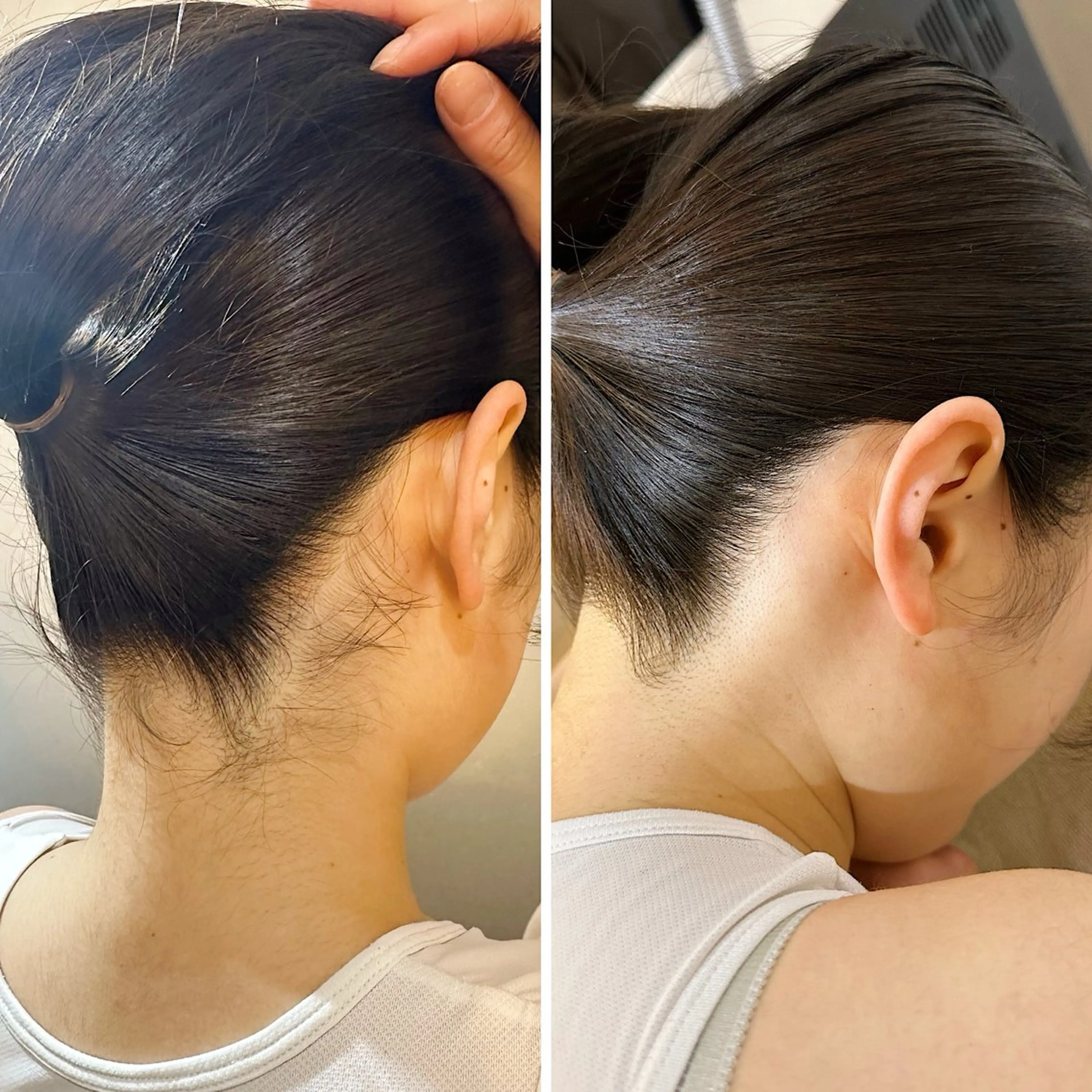 脱毛 うなじ脱毛/美肌脱毛 LABELのエステ・リラクイメージ