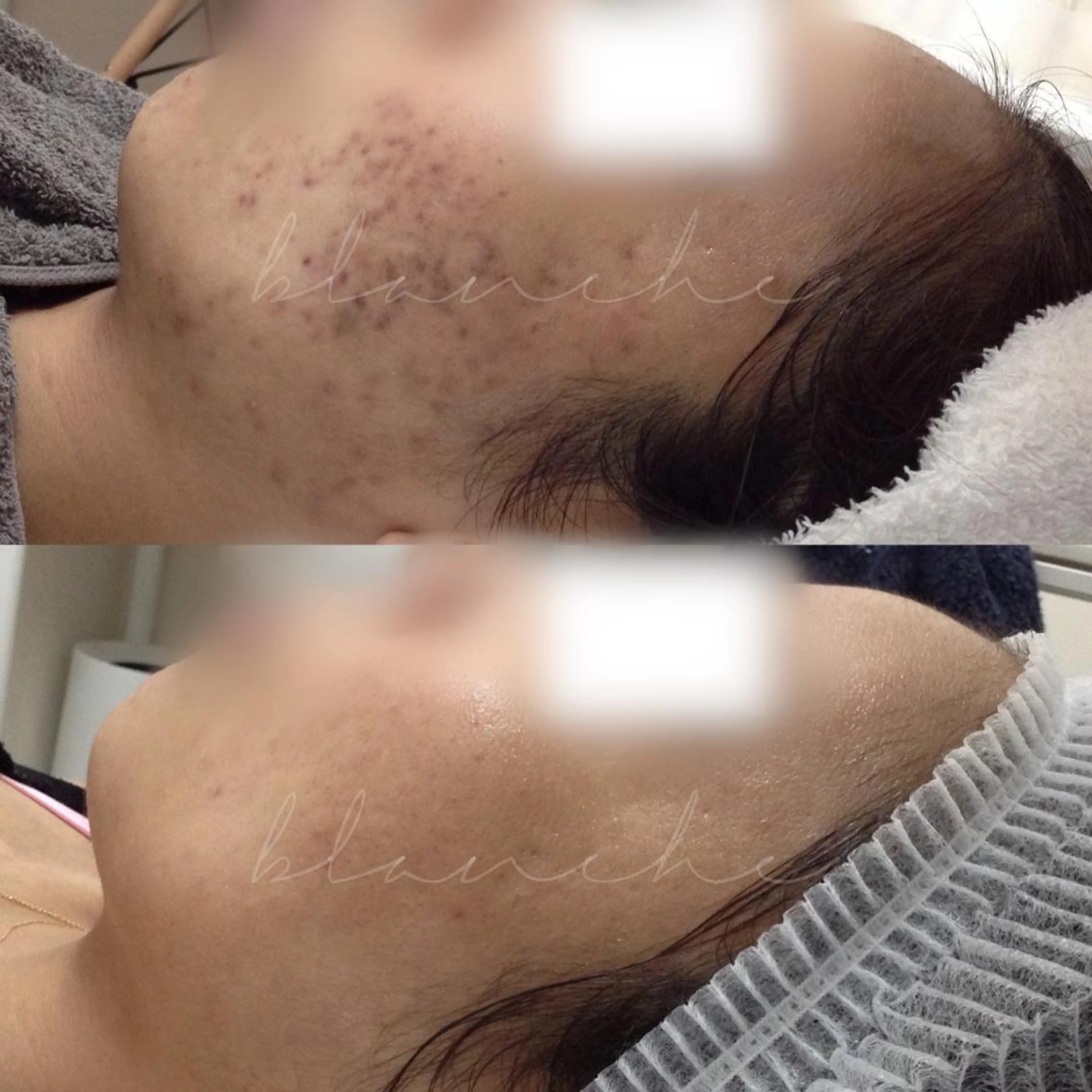 ミディアム カラー パーマ ネイル マツエク・マツパ アイブロウ エステ リラク 都度払い肌質改善 &脱毛Blancheのエステ・リラクイメージ