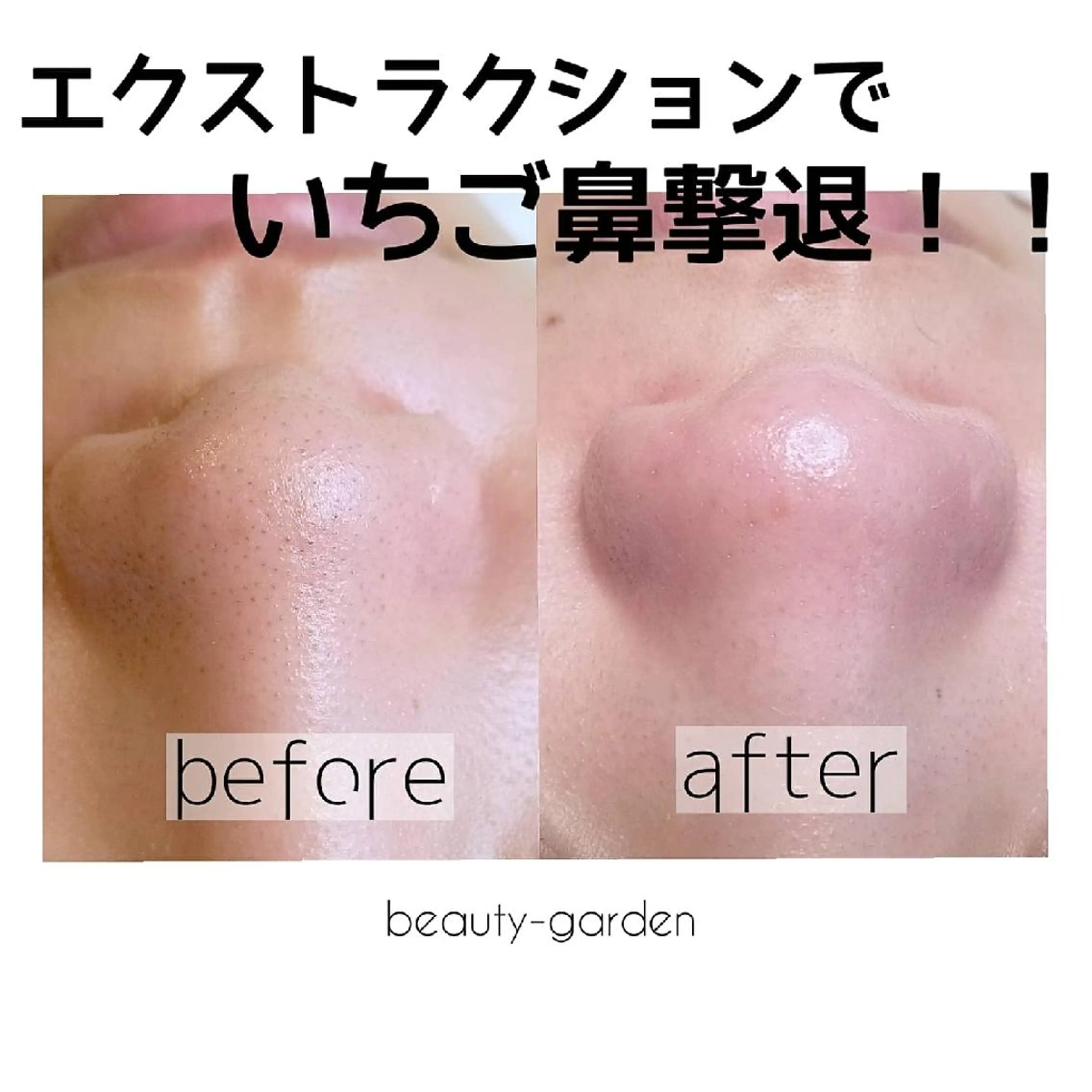 U_la所属・U_la [ウーラ] 片岡の眉毛・アイブロウイメージ