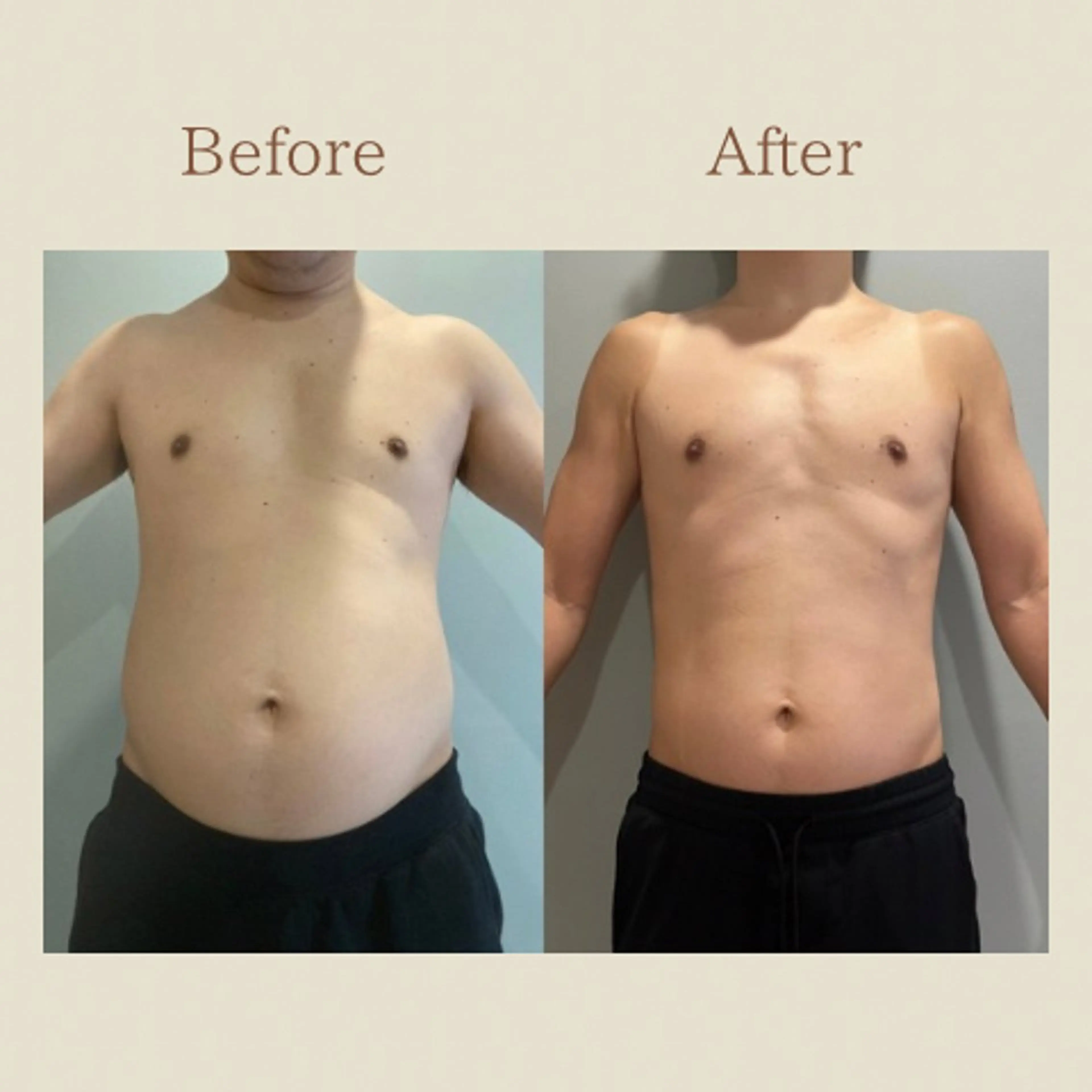 お腹痩せエステ Flat BELLY 恵比寿所属・【腸もみ/脂肪冷却】 お腹エステ/恵比寿のエステ・リラクイメージ