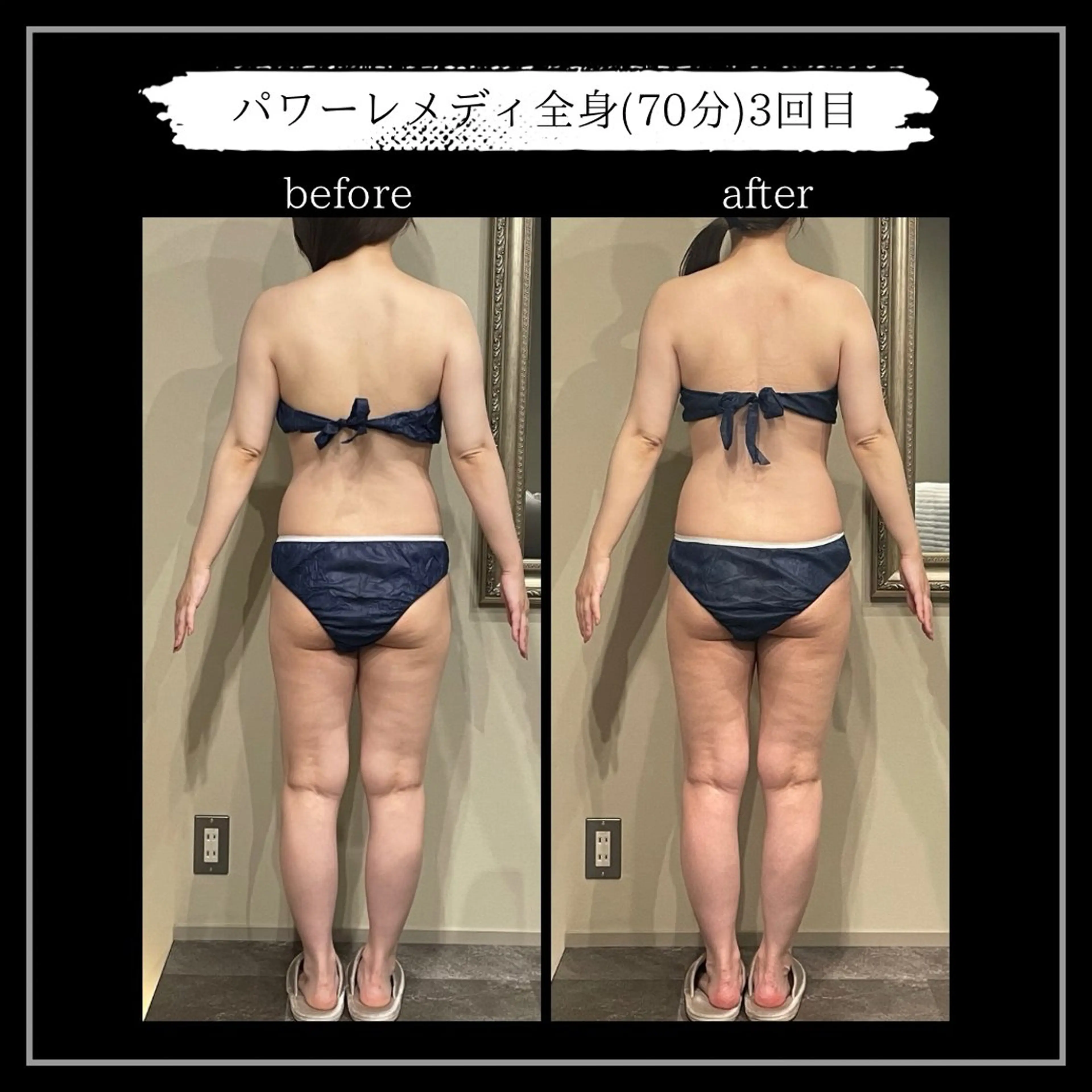 オフ:オン所属・オフ:オン 全身筋膜マッサージのエステ・リラクイメージ