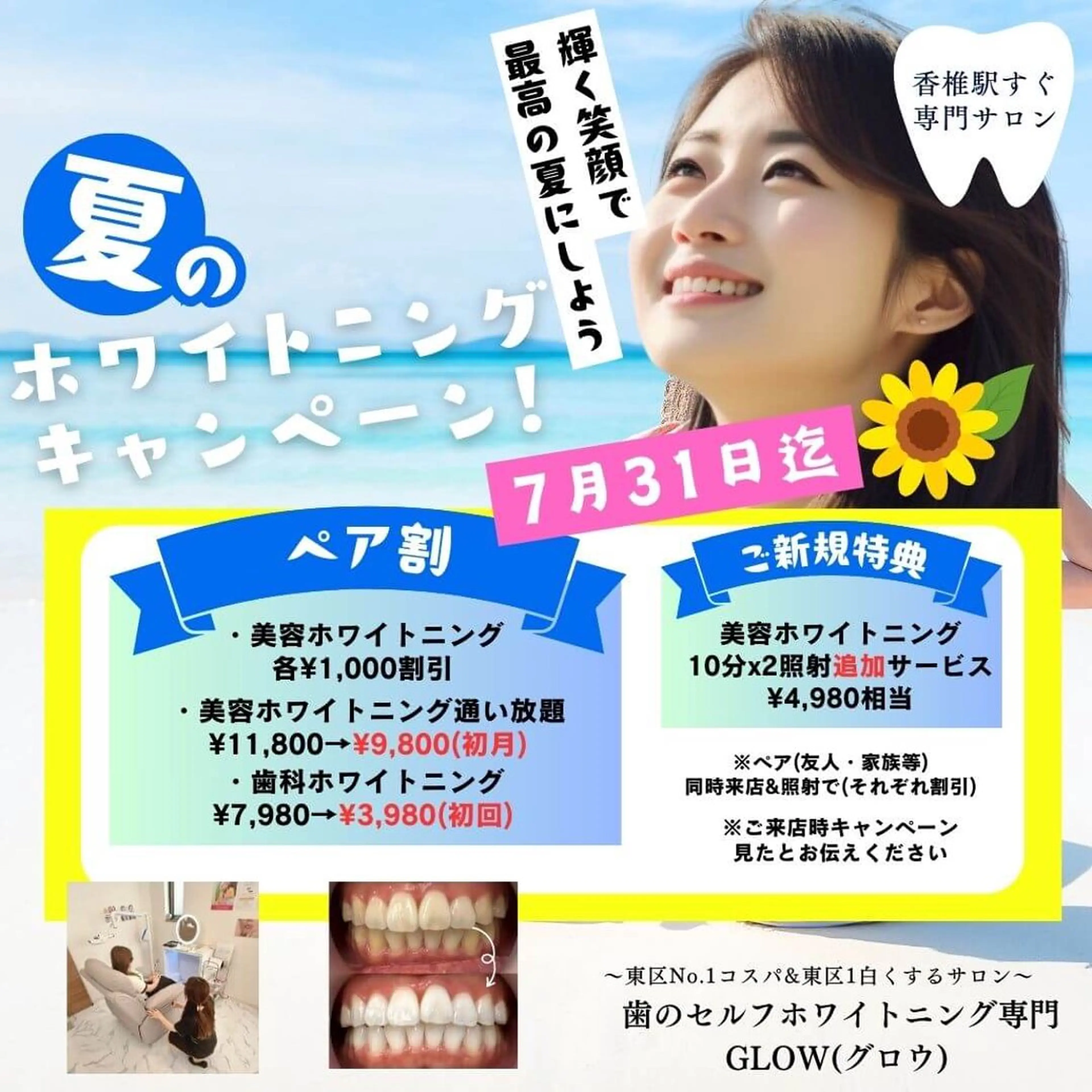 エステ リラク 歯のセルフホワイトニング専門店GLOW（グロウ）所属・東区香椎歯のセルフホ ワイトニングGLOWのその他イメージ