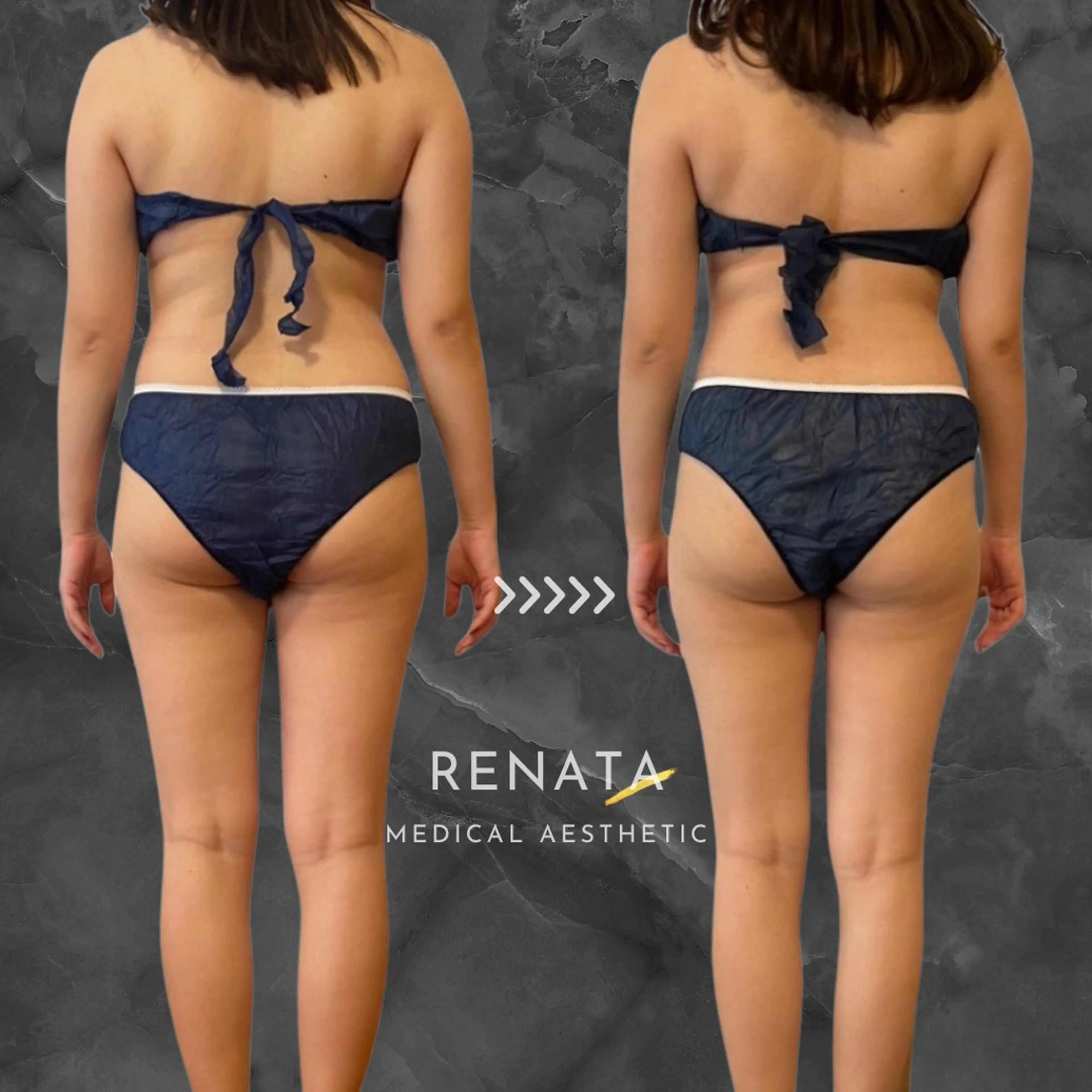 RENATA🕊 脂肪冷却専門店六本木のエステ・リラクイメージ