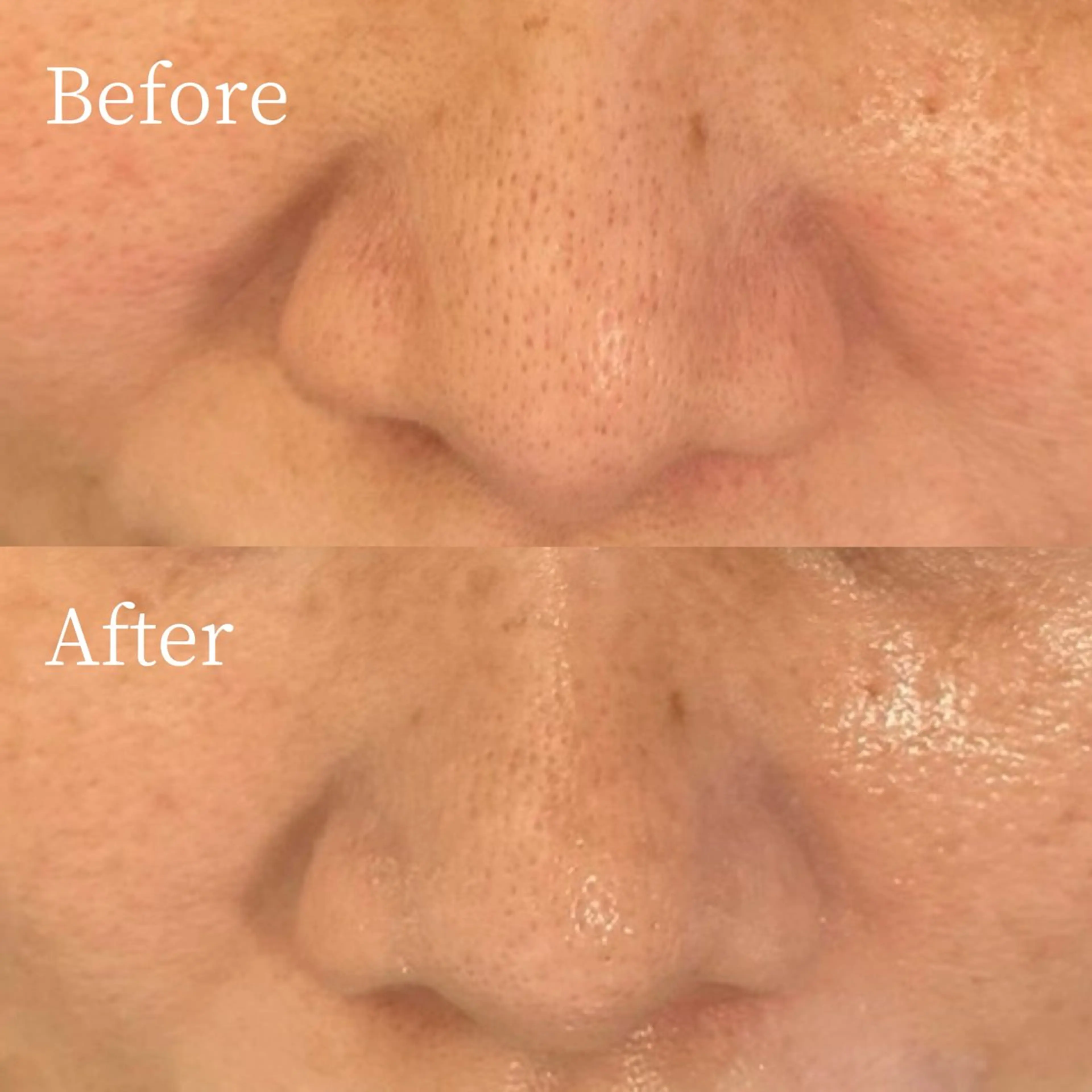 エステ 【肌質ケアサロン】 RUMINIRのエステ・リラクイメージ