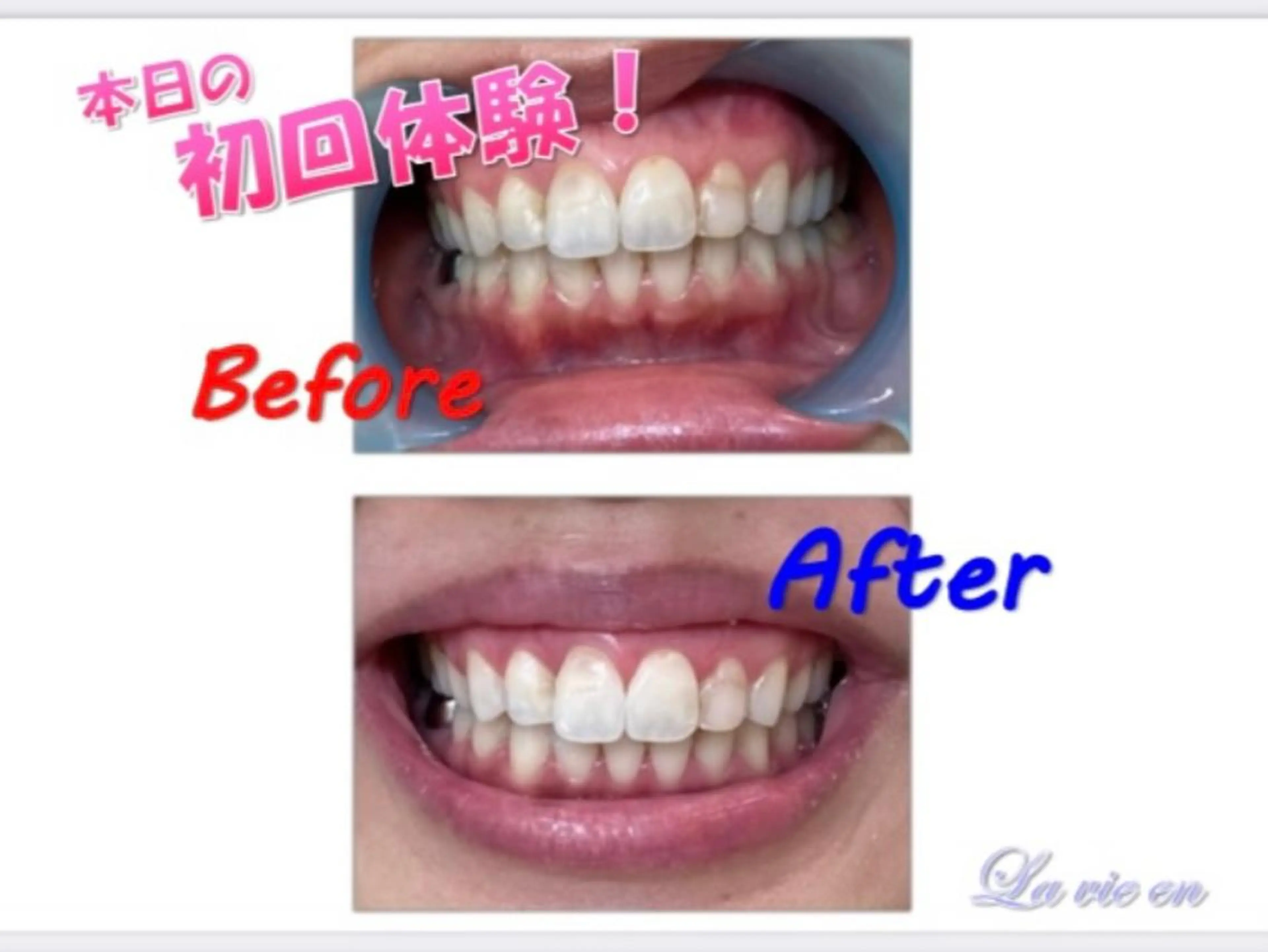 その他 セルフホワイトニングサロン　ラヴィアン所属・ホワイトニングサロン La vie enのその他イメージ