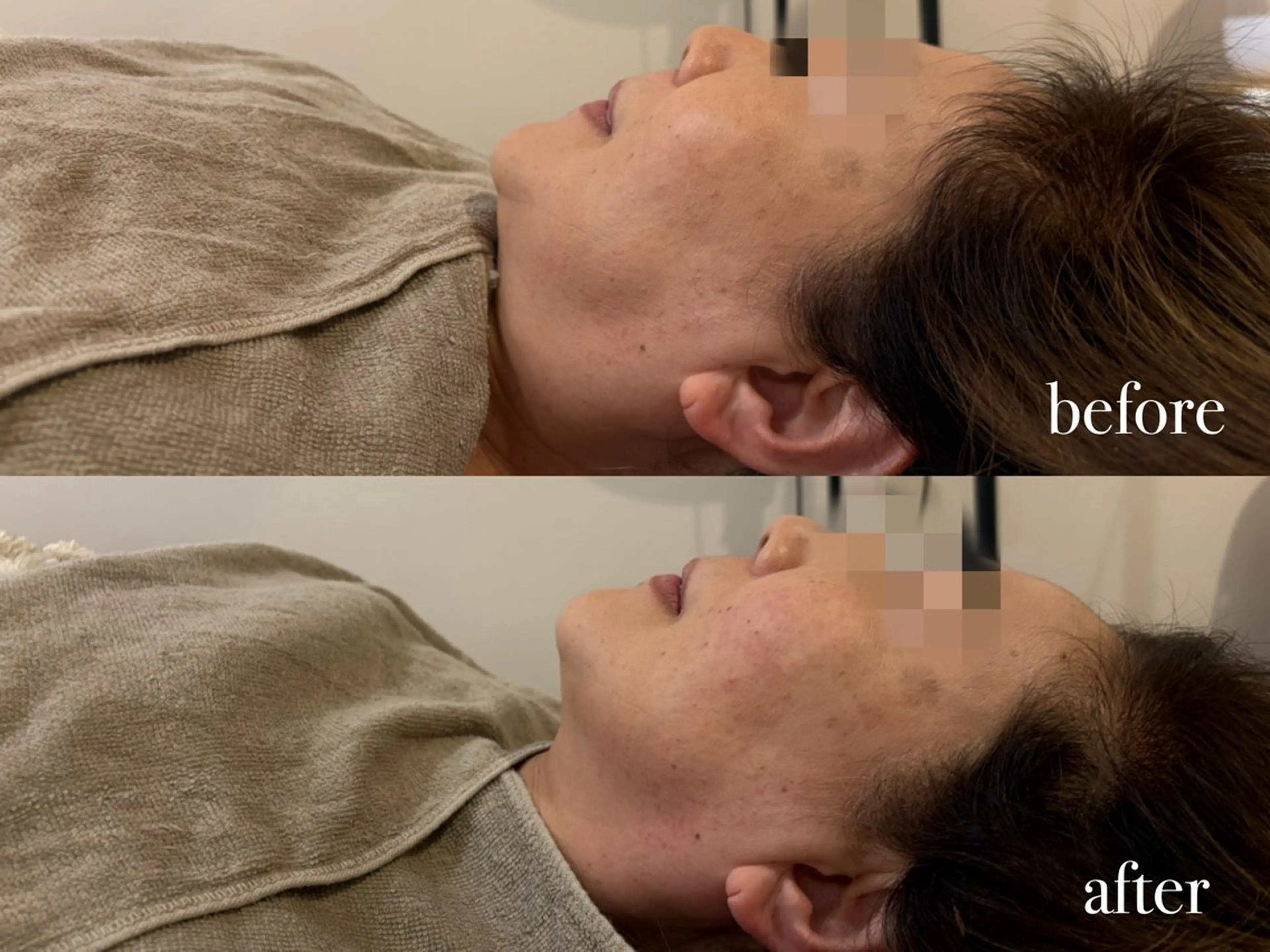 エステ リラク ENNE🦩小顔整体 師🌿 HINAKOのエステ・リラクイメージ