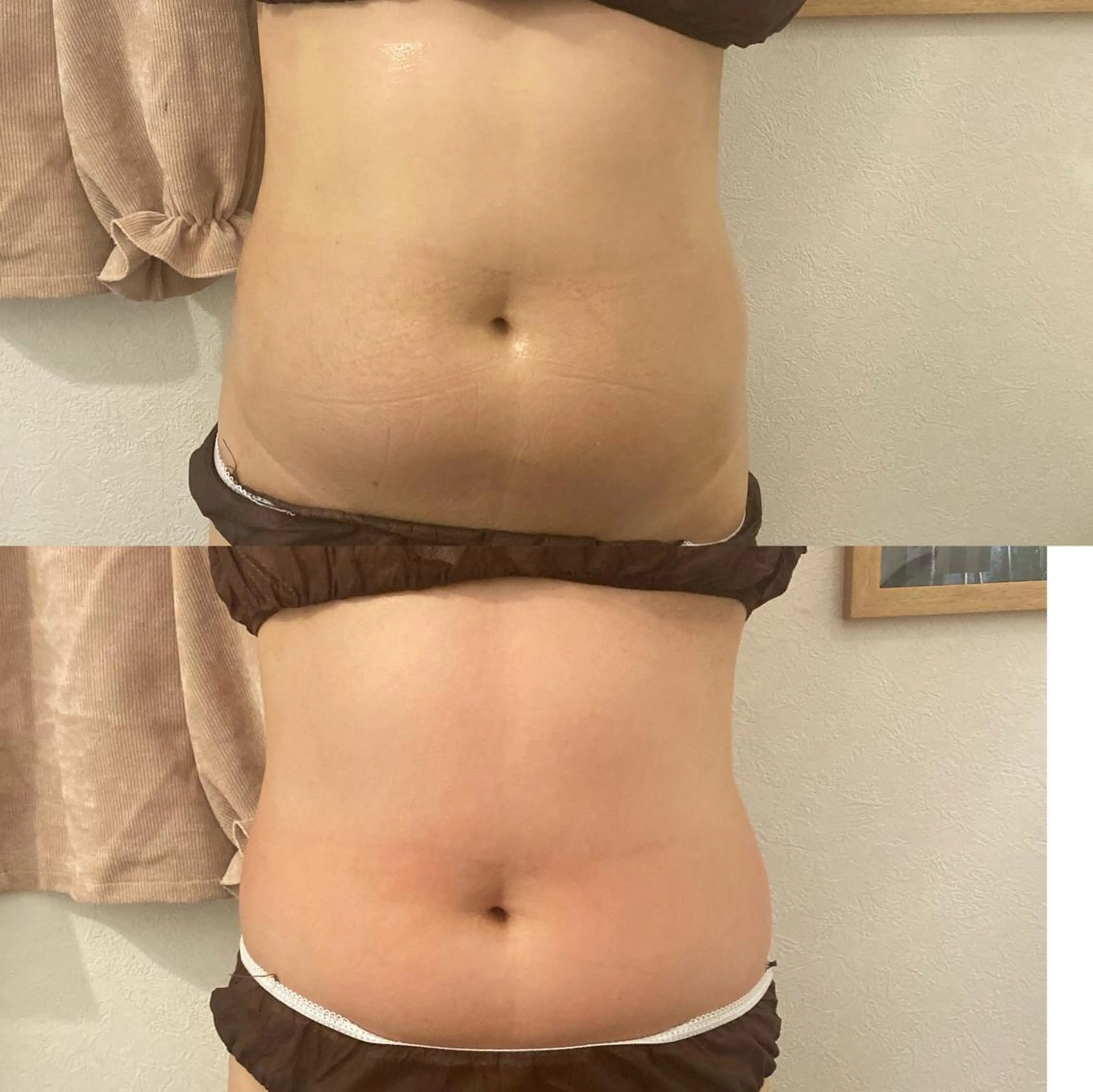 エステ OPREA 千種店のエステ・リラクイメージ