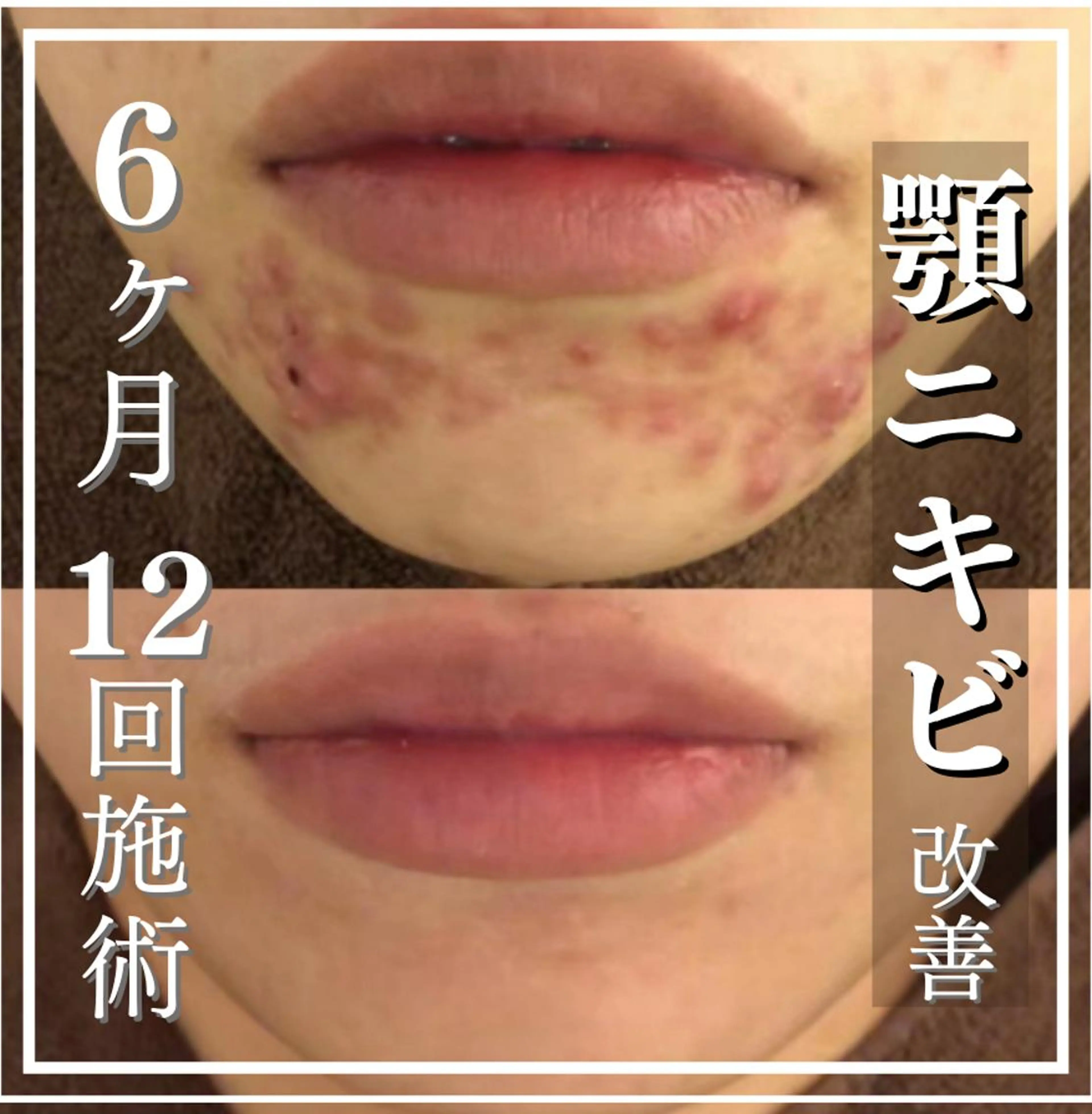 セミロング カラー パーマ ヘアアレンジ メンズ キッズ ネイル マツエク・マツパ アイブロウ ニキビ特化型エステ 🍋最短で肌質改善のエステ・リラクイメージ