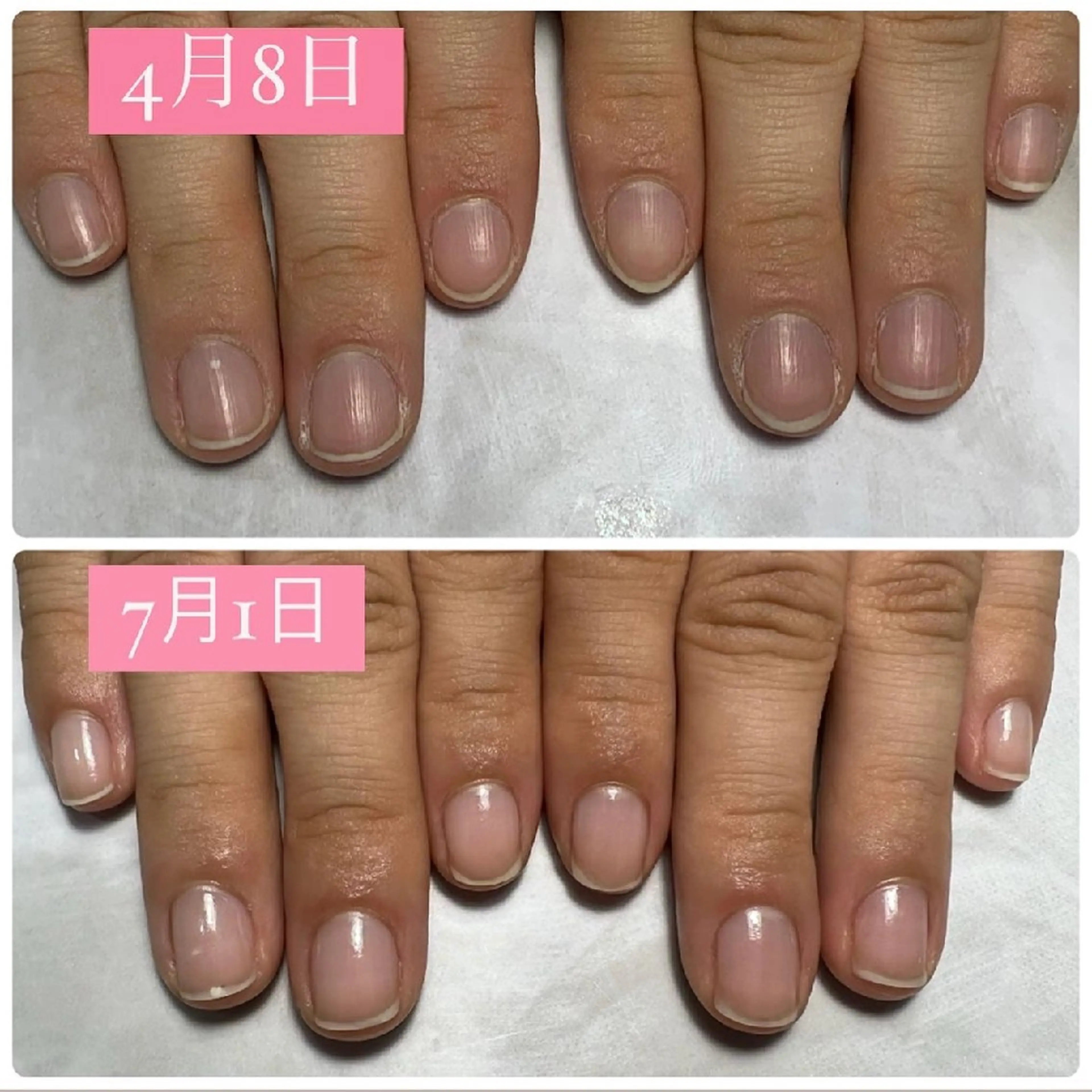 ネイル ジェルネイル ハンドケア AKT NAIL所属・AKT Beauty エステヘッドスパのエステ・リラクイメージ