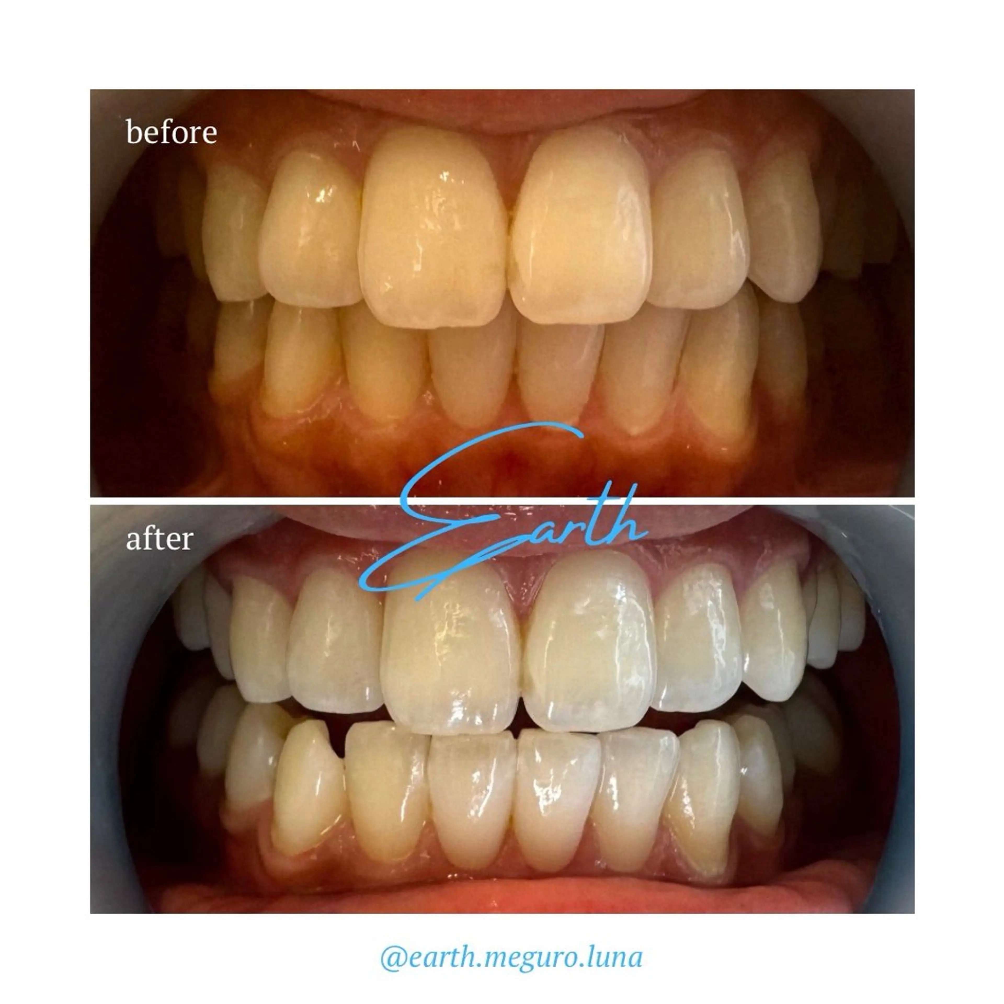 エステ ホワイトニングサロン EARTH目黒店のその他イメージ