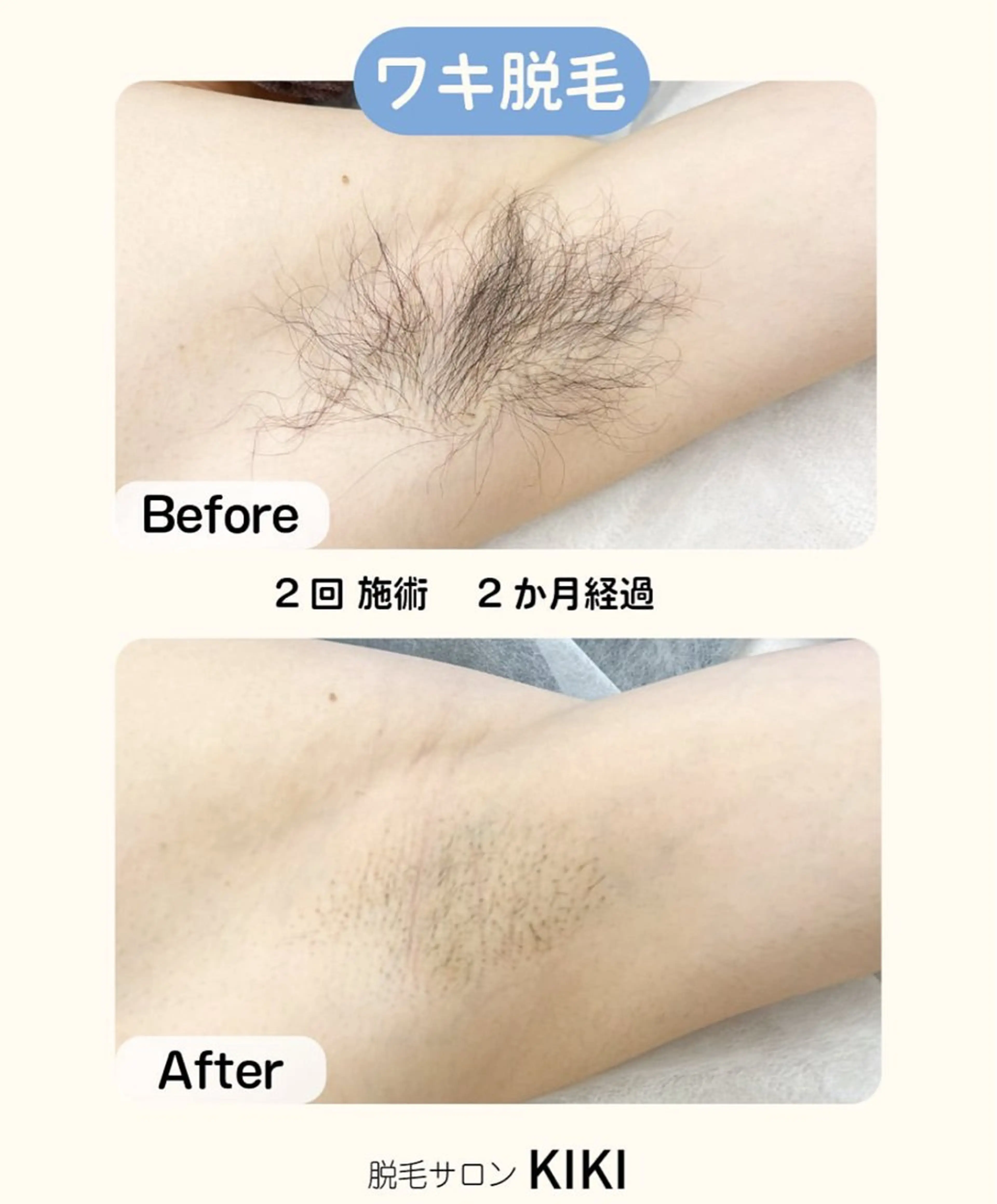 脱毛サロンKIKI所属・脱毛サロンKIKI みゆのエステ・リラクイメージ